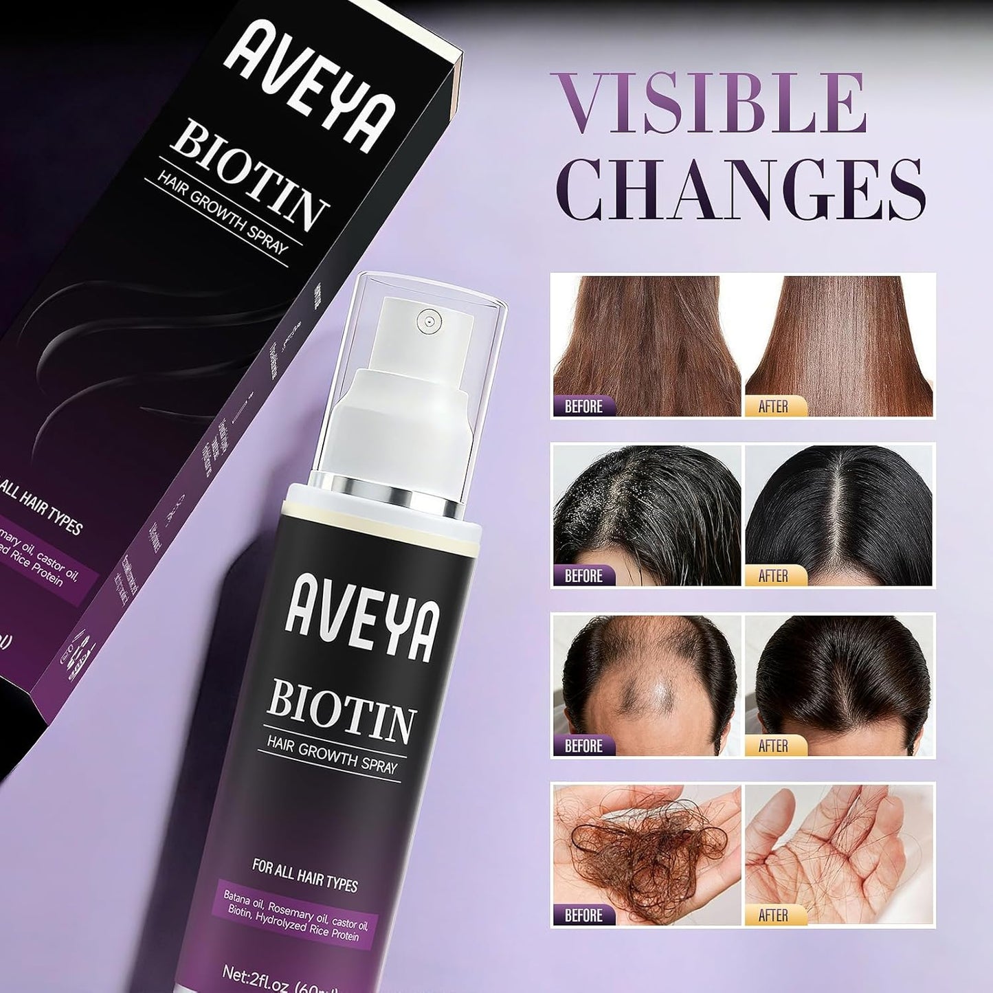 Hair Growth Serum for Women & Men - Rosemary Oil, Batana Oil & Biotin - Non-Greasy Formula | 60ml