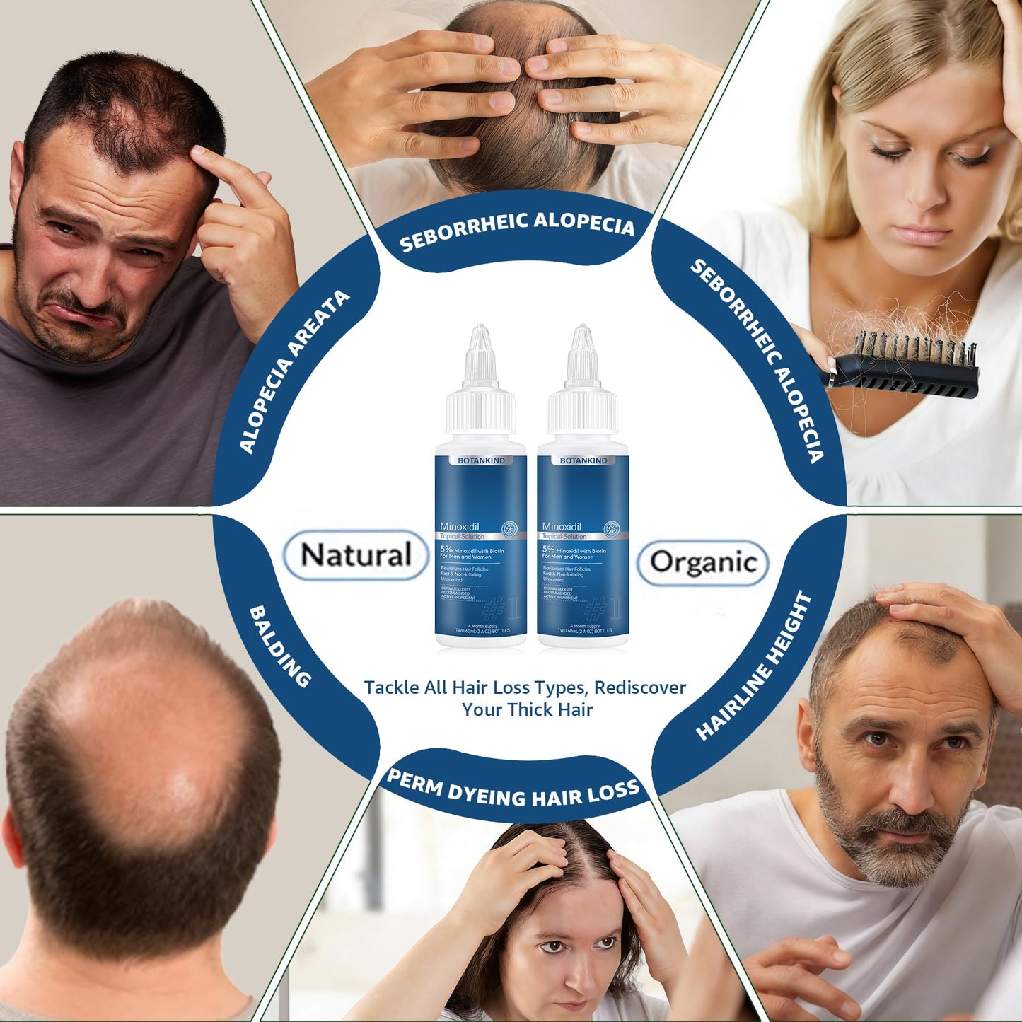 5% Minoxidil with Biotin for Men and Women, Hair & Beard Growth Serum, Topical Minoxidil Solution for Thinning Hair Loss，Extra Strength, 2 Pack