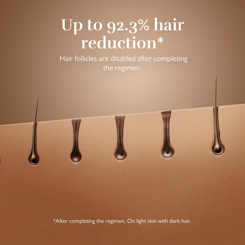 Silk'n 7 IPL Hair Removal Device for Women and Men, FDA-Cleared Permanent Hair Reduction at Home, 360° Rotating Head, Galvanic + IPL Technology, 3 Smart Attachments, Skin Tone Sensor, Painless, Gold