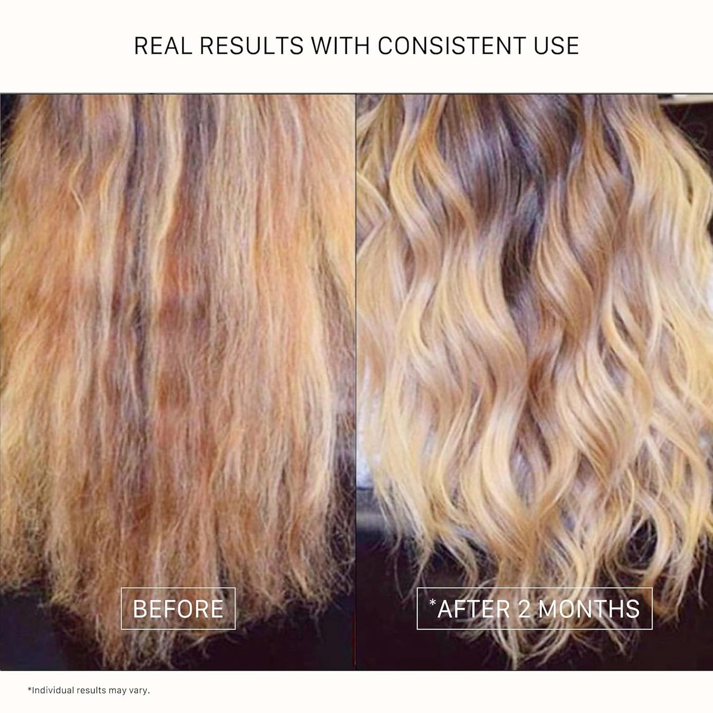 ACTIIV Renew Healing Shampoo Treatment - Plant-Based, Vegan Formula for Healthy, Beautiful Hair | All Hair Types