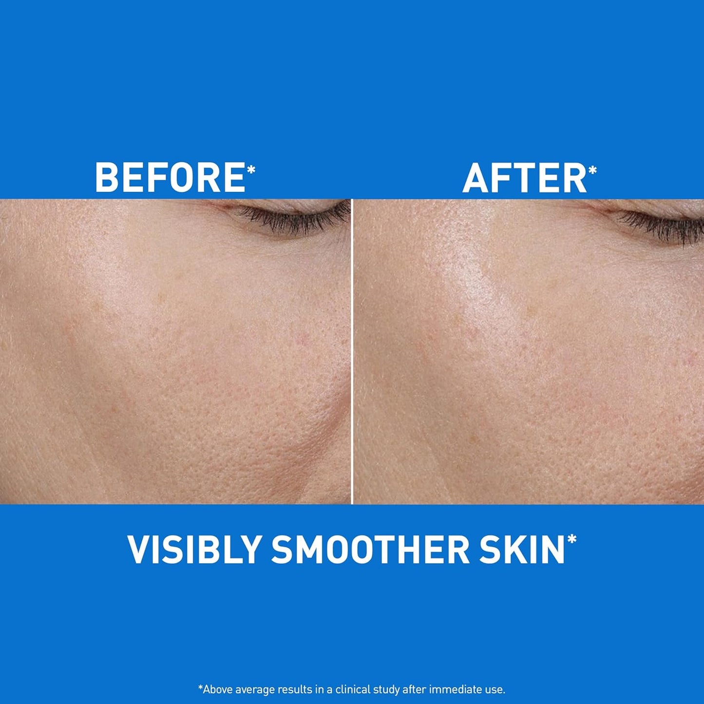 CeraVe Hydrating Hyaluronic Acid Gel - Lightweight Facial Moisturizer for Sensitive Skin | 1.7oz
