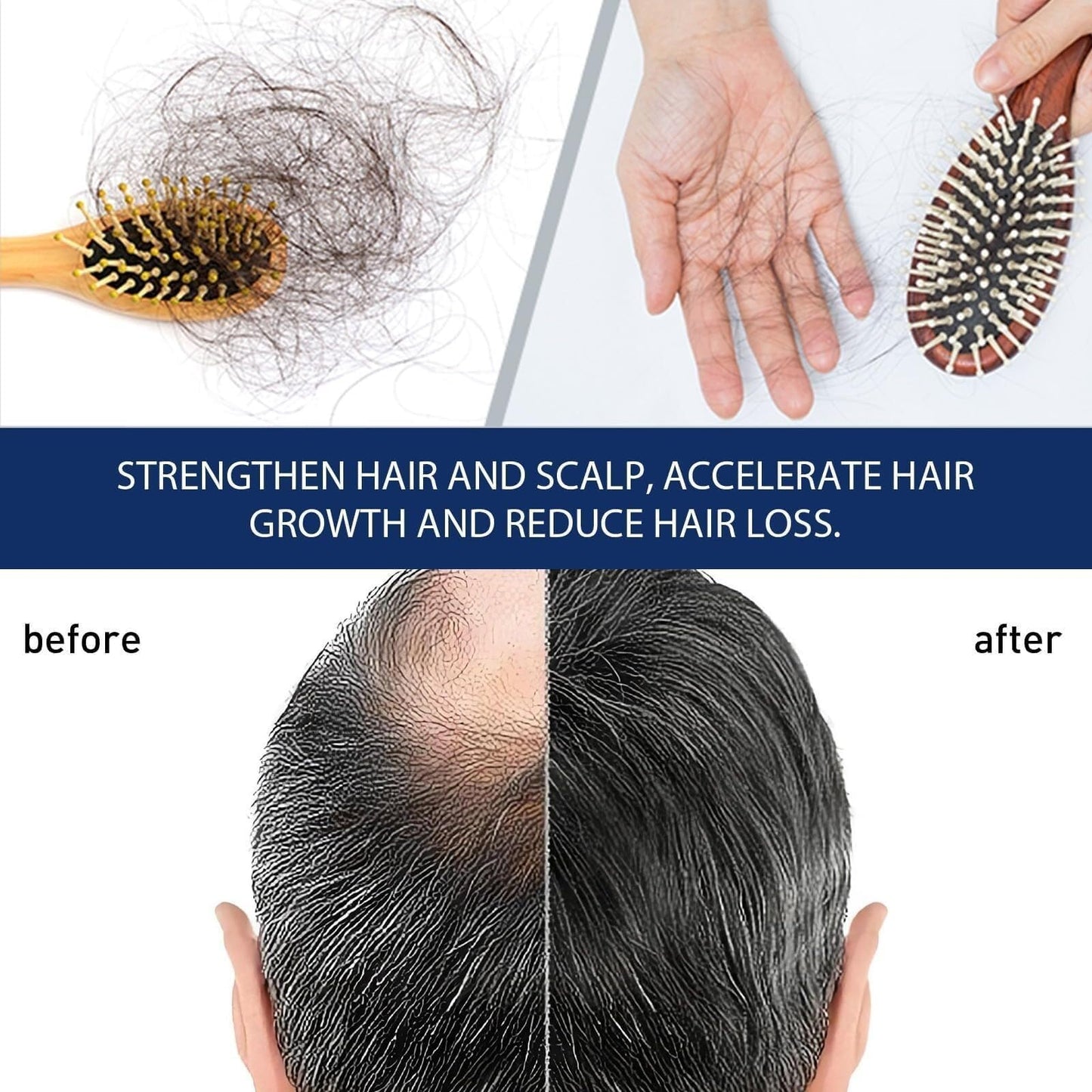 Alopecia Hair Products Suitable for Men & Women
