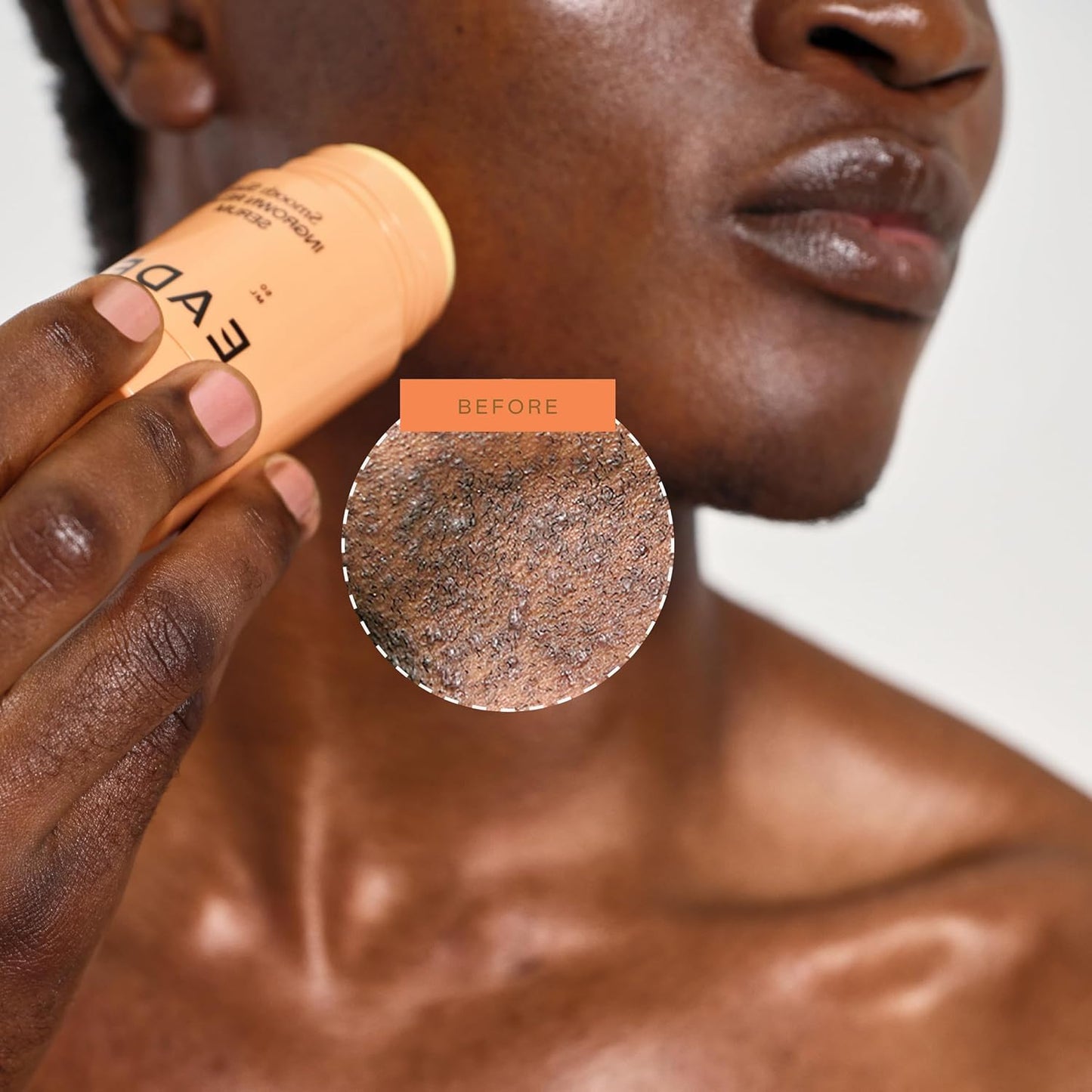 Eadem Smooth Slate Ingrown Hair Roller Serum - Targets Bumps & Faded Scars | AHAs for Dark Spots