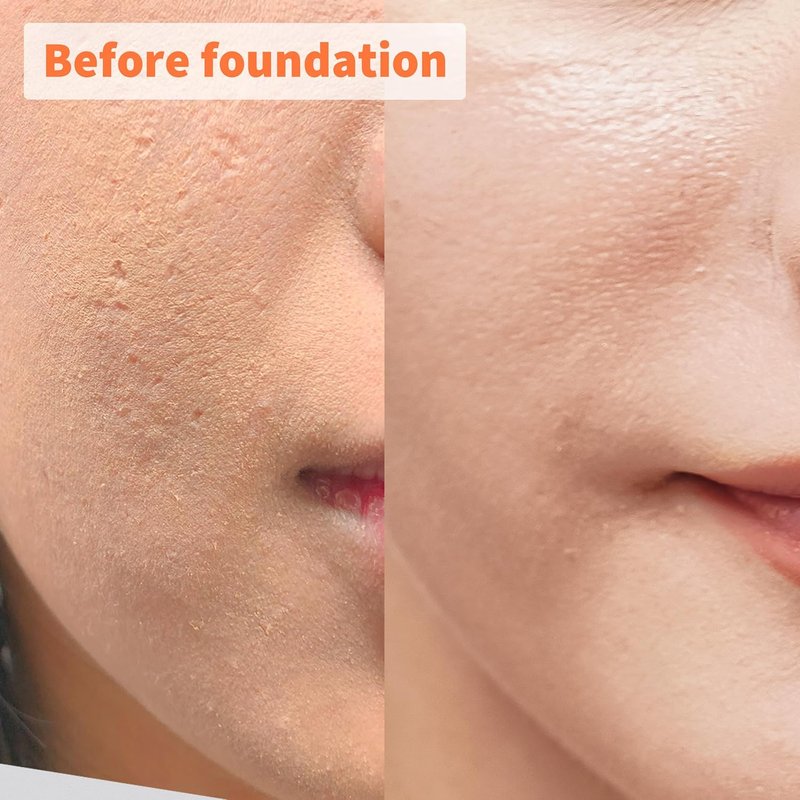 Hyaluronic Acid Face Serum - Anti-Aging Wrinkle Filler for Dewy Skin | 13 Types of HA for All-Day Hydration