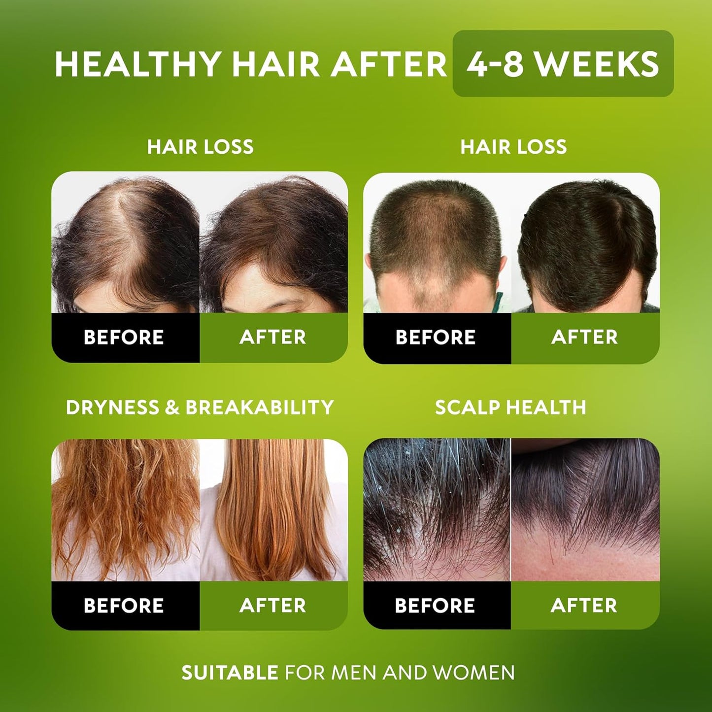 Batana Oil for Hair Growth - Organic Cold Pressed Hair Mask for Thicker Hair & Scalp Health | 4.23 oz