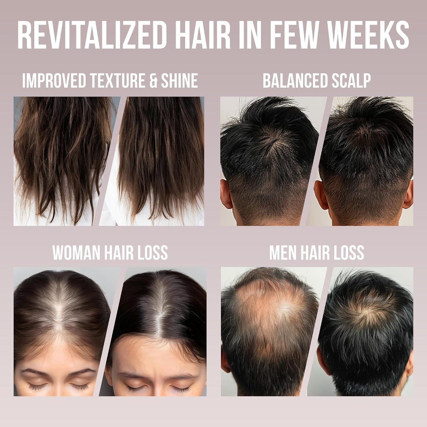 Raw Batana Oil for Hair Growth - 100% Pure Organic Treatment for Thick, Strong Strands | 4 Fl Oz, Includes Shower Cap
