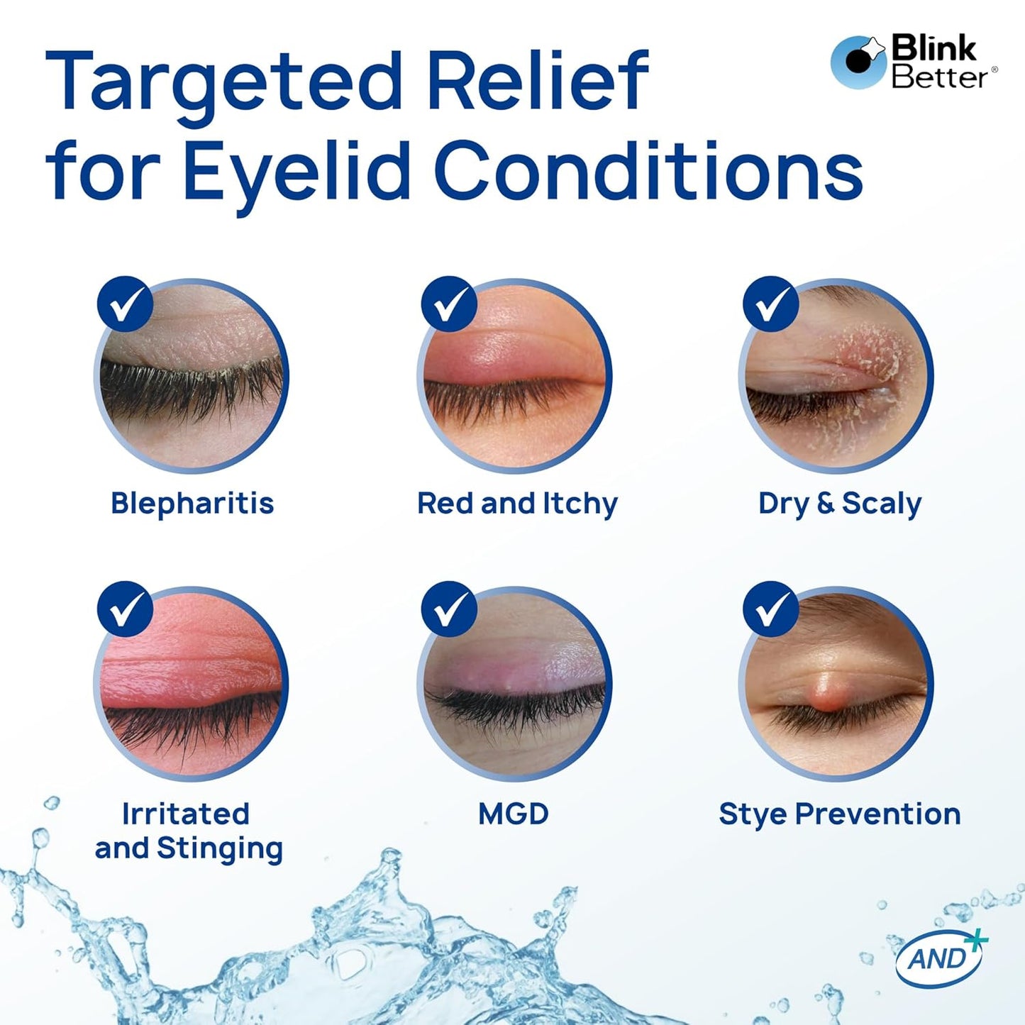 BetterLids Eyelid Spray - Boosted Hypochlorous Acid Mist for Blepharitis | Gentle Non-Sting Cleanser, 50 ml
