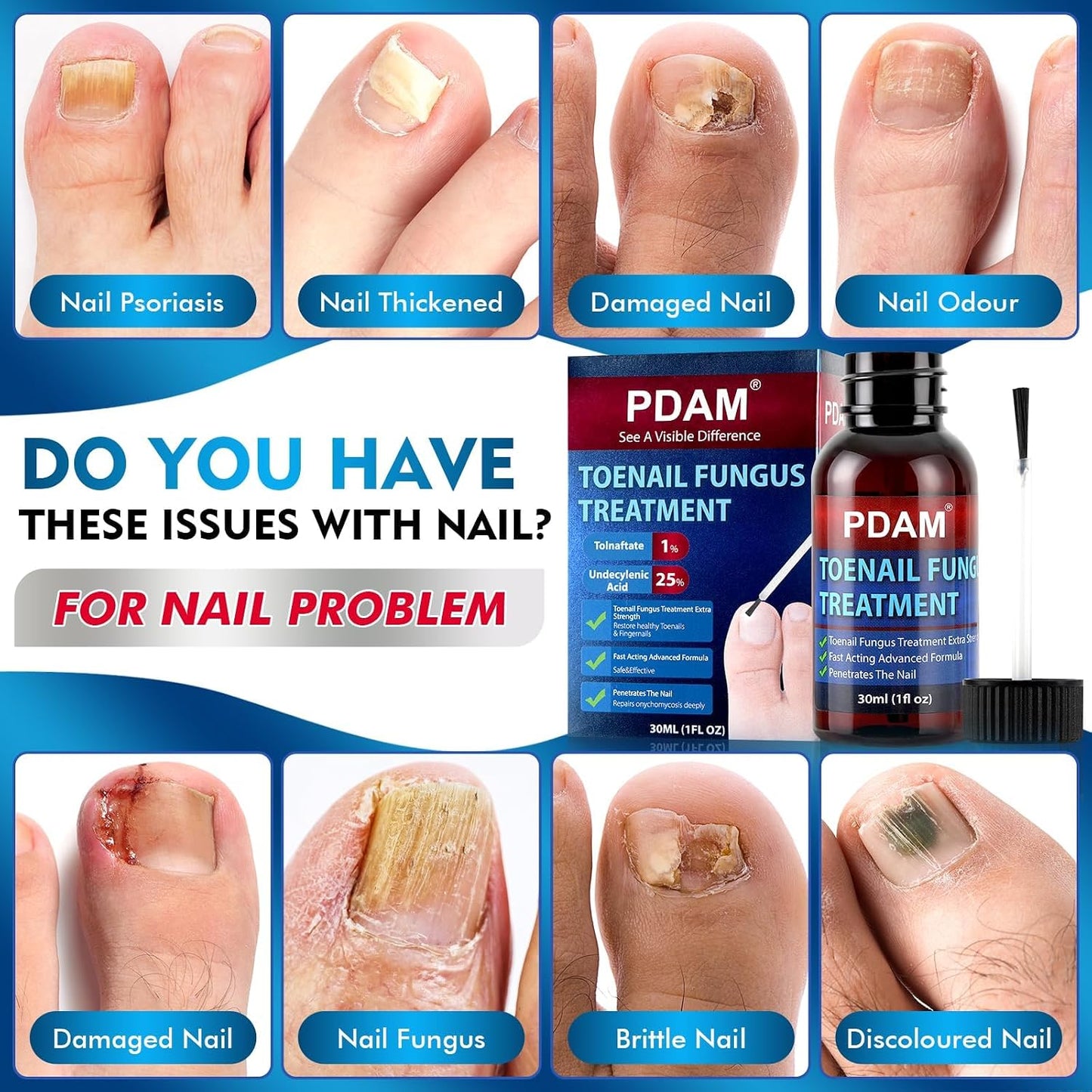 Toenail Fungus Treatment - Extra Strength Nail Strengthener for Thick, Discolored & Ingrown Nails | 30ml