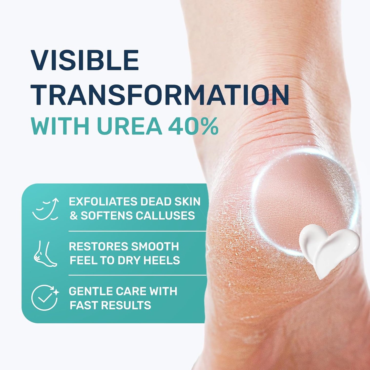 Urea Cream 40% for Feet - Maximum Strength Exfoliating Foot Lotion with Salicylic Acid | 4.3 oz