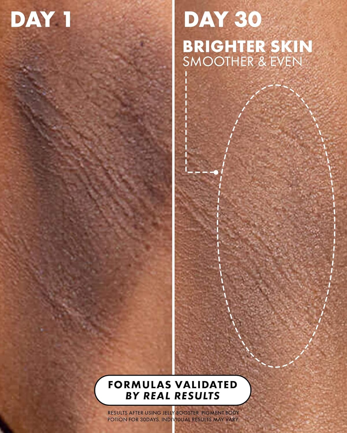 Truly Beauty Jelly Booster Pigment Body Potion - Dark Spot Treatment with Pomegranate Extract & Vitamin B12 | Hydrates & Smooths Skin (3.1 fl oz)