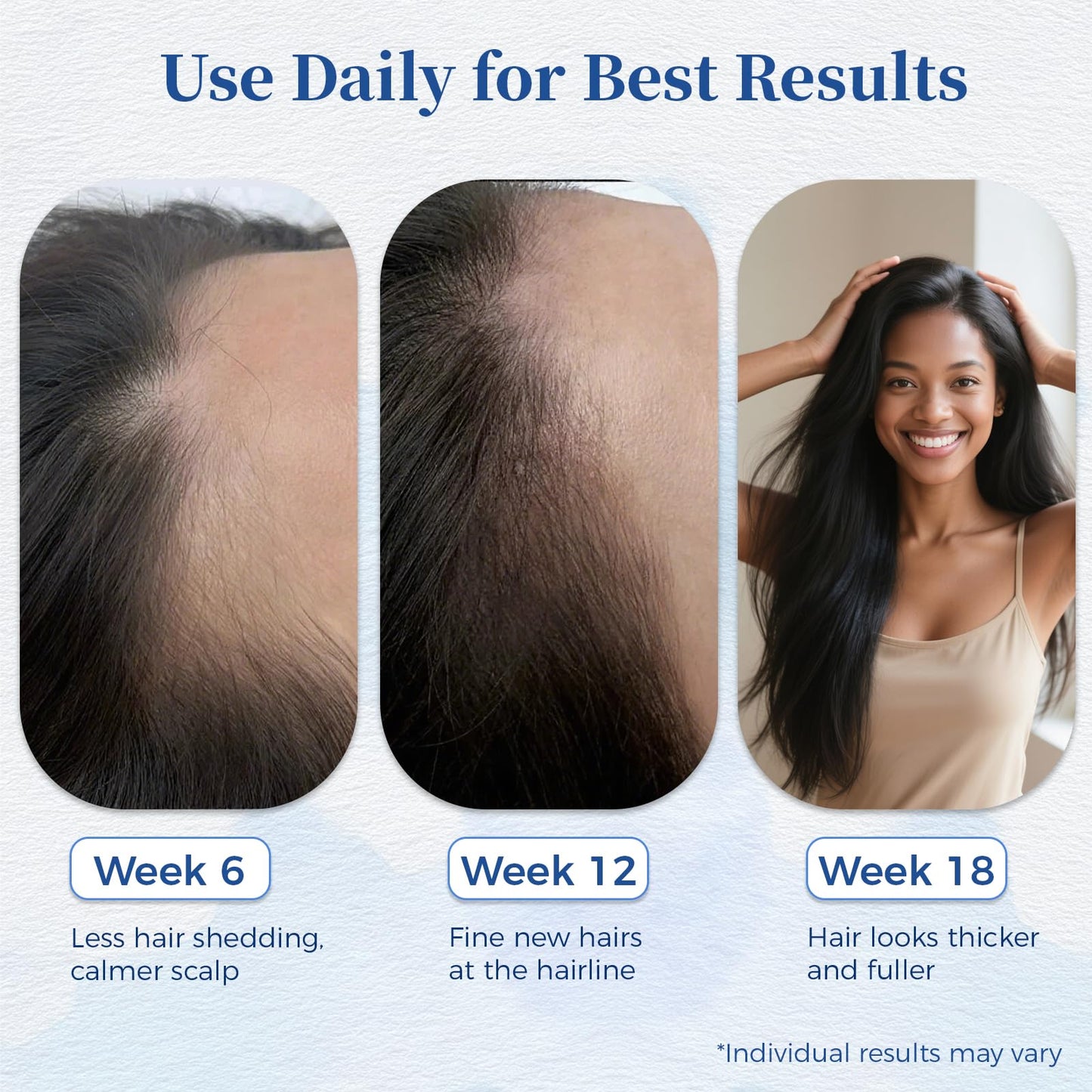 Gluvelessia Hair Growth Serum Roll On with Rosemary，Helps Support Thicker, Fuller Hair Appearance，Clean, Non-Greasy Hair Loss Support for Men & Women，Saw Palmetto，0.84 Fl Oz (Pack of 3)
