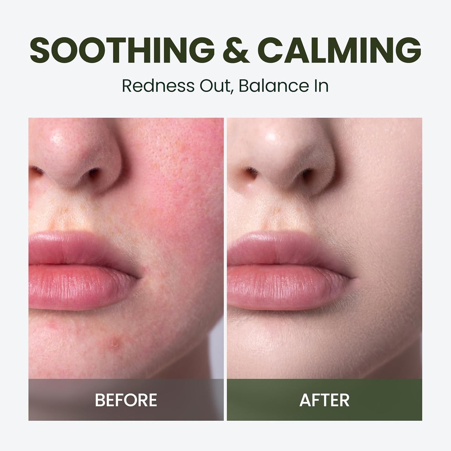 Calming Ampoule Serum for Sebum Control & Pore Care - Cica & Hyaluronic Acid, Vegan Formula | Fast-Absorbing Korean Skin Care