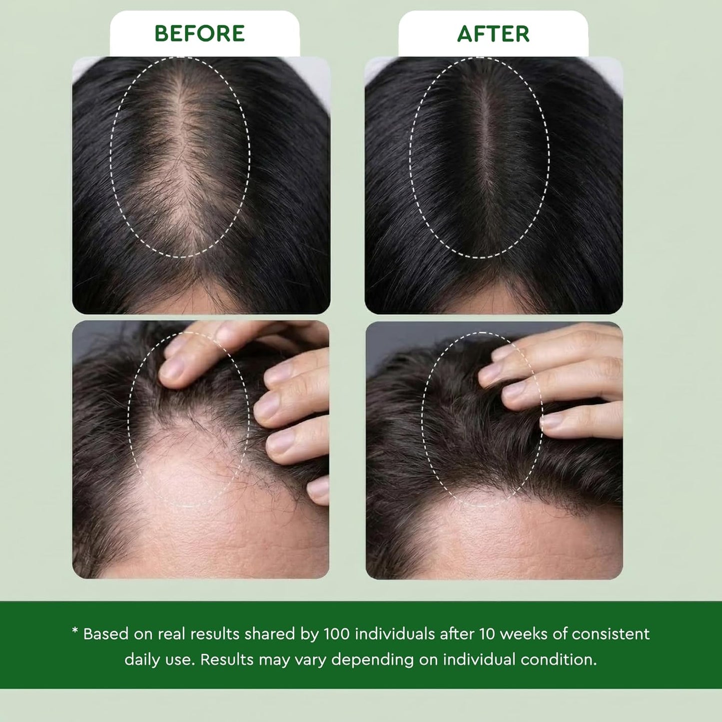 Rosemary Hair Growth Serum - Lightweight Ginger Formula for Thinning Hair | Non-Greasy Scalp Care (0.5 Fl Oz)
