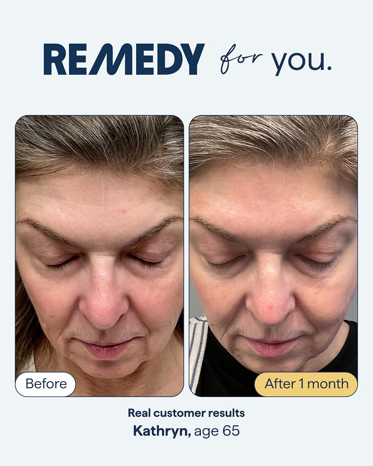 Anti-Aging Treatment - Retinal, Resveratrol & Glycolic Acid | Reduce Wrinkles & Even Skin Tone