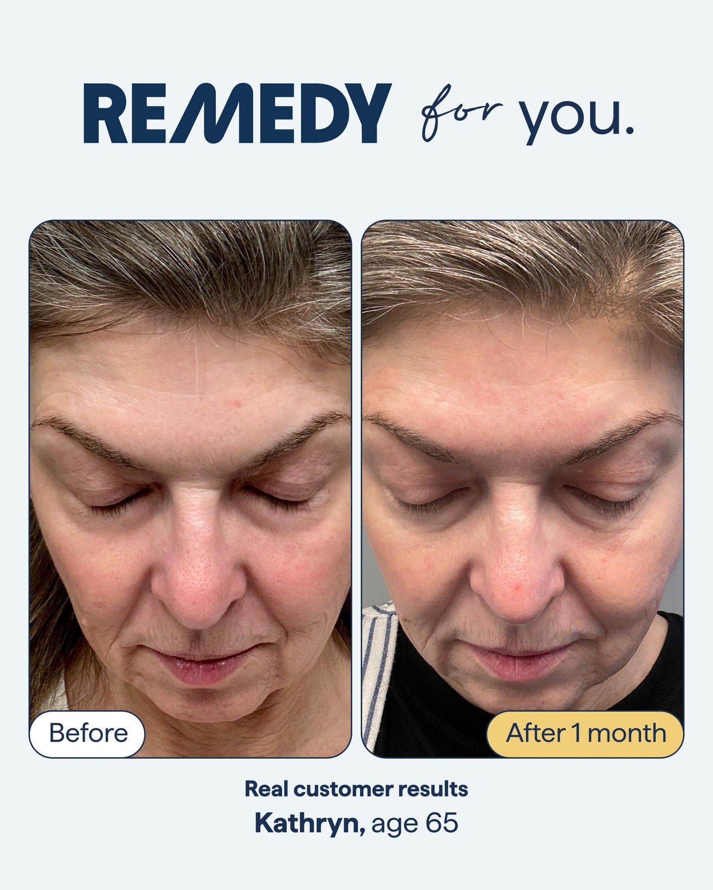 Remedy for Healthy Aging - Retinal, Resveratrol, Glycolic Acid, Argireline, Ferulic Acid, Matrixyl 3000 - Anti-Aging Treatment for Wrinkles, Uneven Texture & Tone - By Dermatologist Dr. Shah