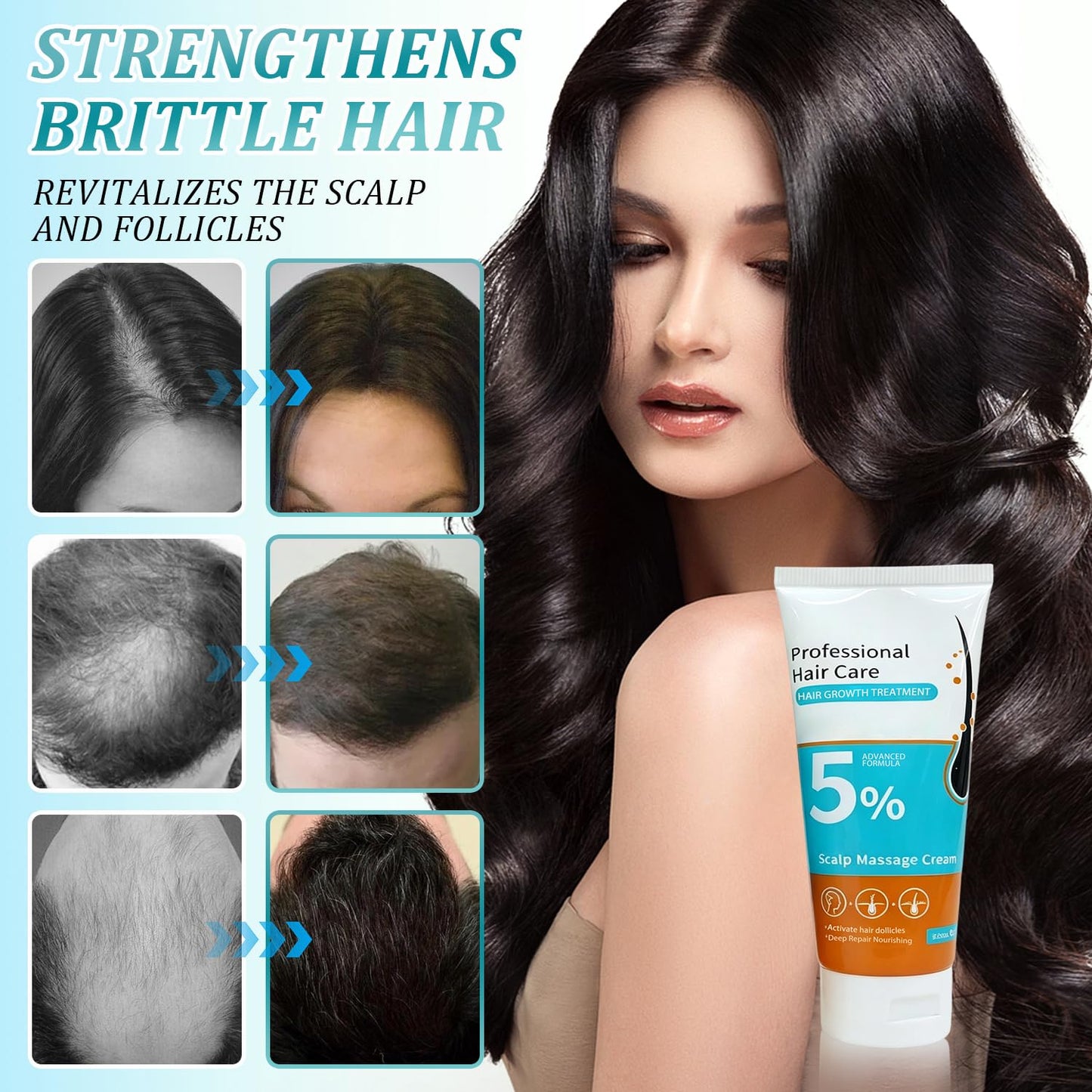 Minoxidil Hair Growth Cream - Anti Hair Loss Treatment for Men & Women | Fast Regrowth & Strengthens Roots (2PCS)