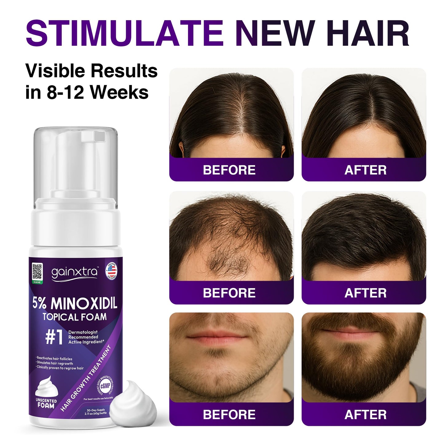 5% Minoxidil Topical Foam for Men & Women - Hair Regrowth Treatment with Minoxidil Foam Mens for Thicker, Fuller Hair - Minoxidil for Men & Women Hair Loss Treatment (Pack of 3)