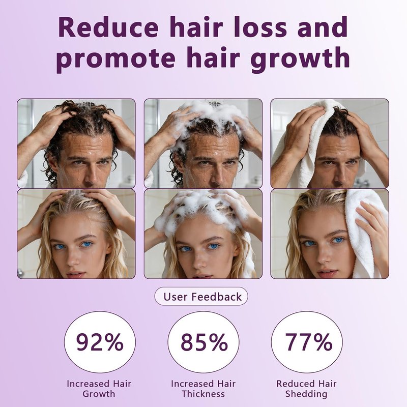Onion Shampoo for Hair Growth - Biotin & Rosemary Oil for Thicker, Stronger Hair | Anti-Hair Loss Formula