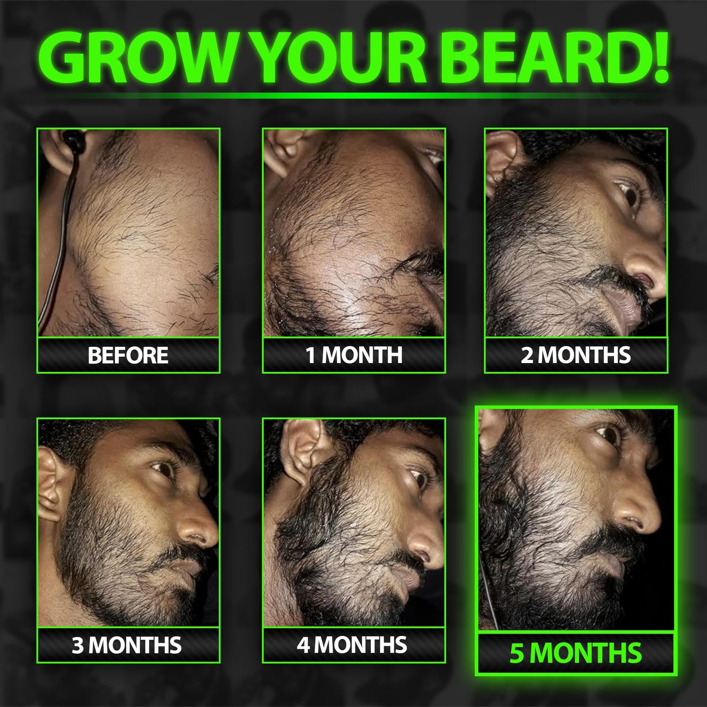 Beard Growth Kit w/GROW XXL Beard Oil for Men/Conditioner & Accelerator for Facial Hair + GROW 11-in-1 Mens Shampoo & Conditioner (Hair Growth Shampoo for Men w/Biotin) - Formulated in America