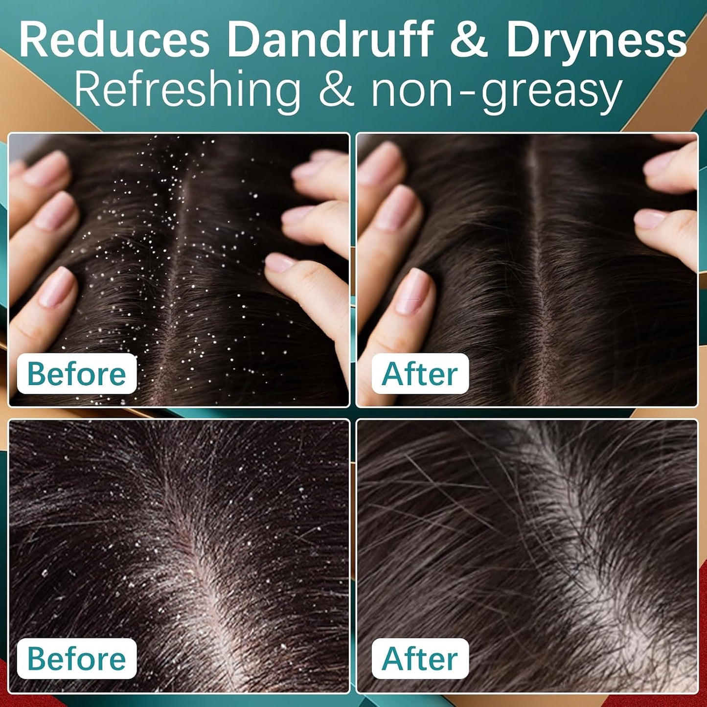 Minoxidil Hair Growth Cream - Anti Hair Loss Treatment with Rosemary & Biotin | For Men & Women, 5% Formula