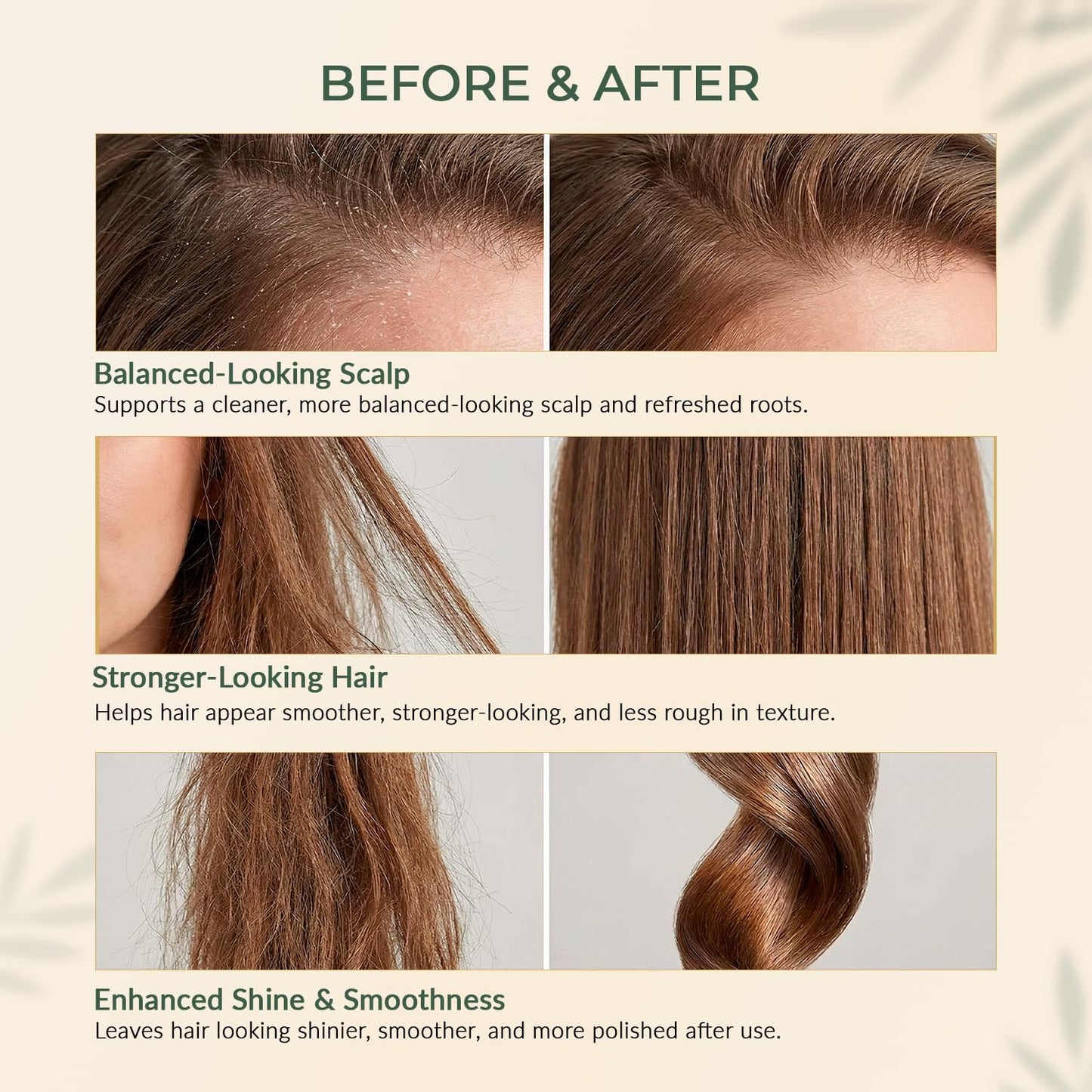 Onion Hair Oil with Rosemary & Argan - Nourishes Scalp & Hair | 6.76 oz, Vitamin E & Jojoba Oil, Sulfate-Free