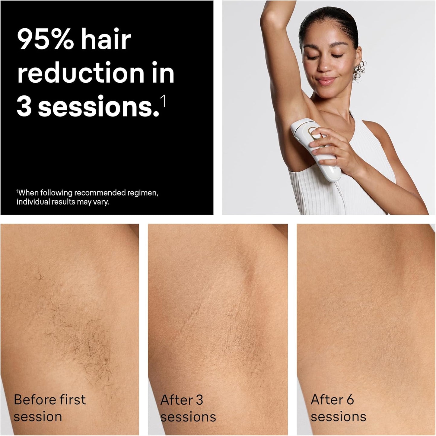 Braun Silk·Expert Pro 5 - IPL Hair Removal Device for Women & Men | At-Home Permanent Laser Hair Reduction, 4 Heads