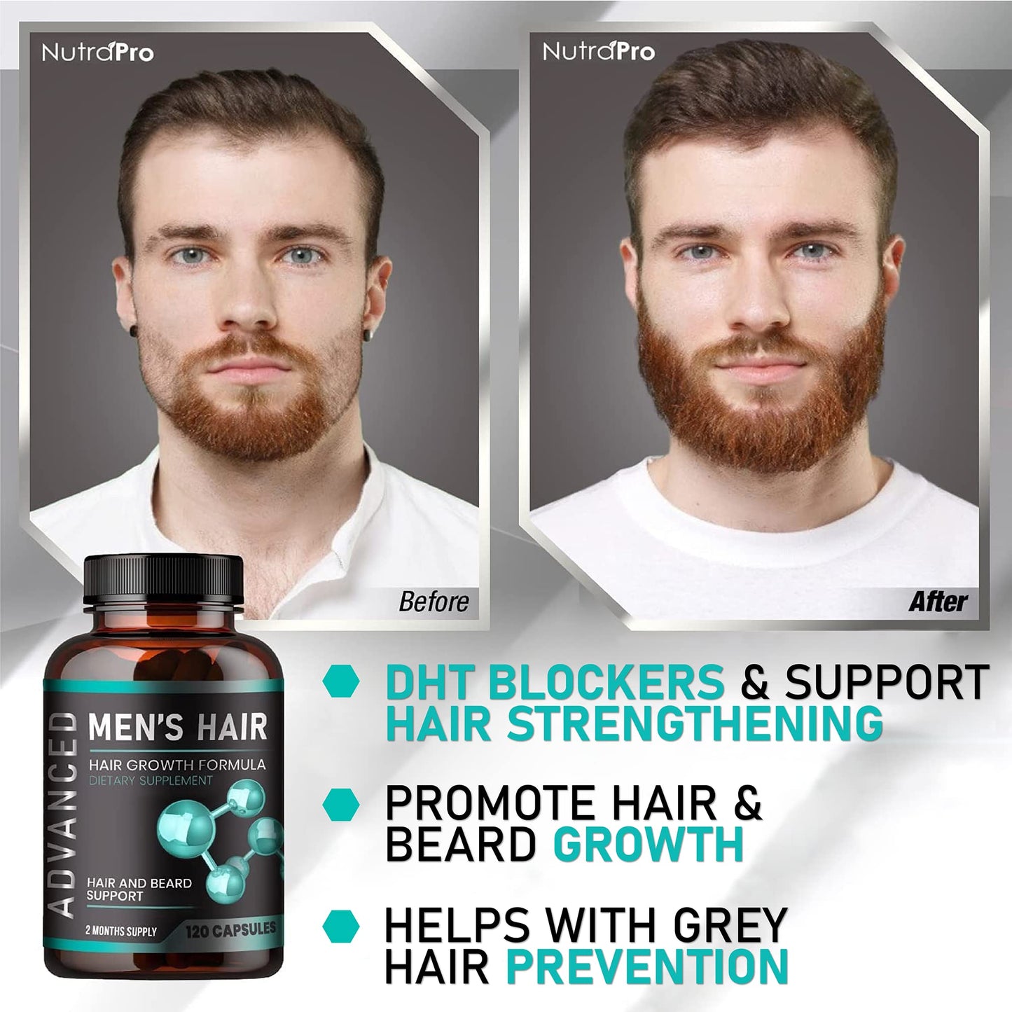 Hair Growth Vitamins For Men - Anti Hair Loss Pills. Regrow Hair & Beard Growth Supplement For Volumize, Thicker Hair.Stop Hair Loss And Thinning Hair With Biotin & Saw Palmetto Hair Vitamins.120 Caps
