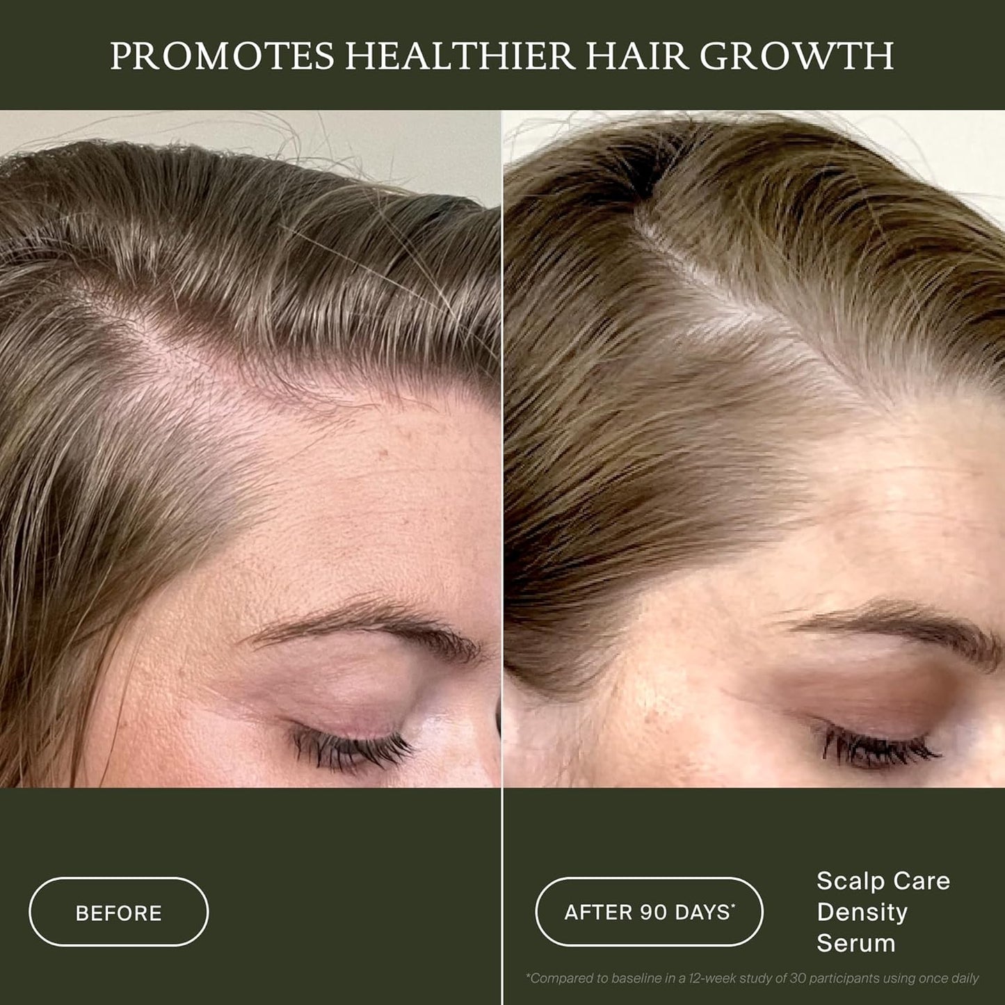 Living Proof Scalp Care Density Serum - Boost Hair Thickness & Volume 2 oz