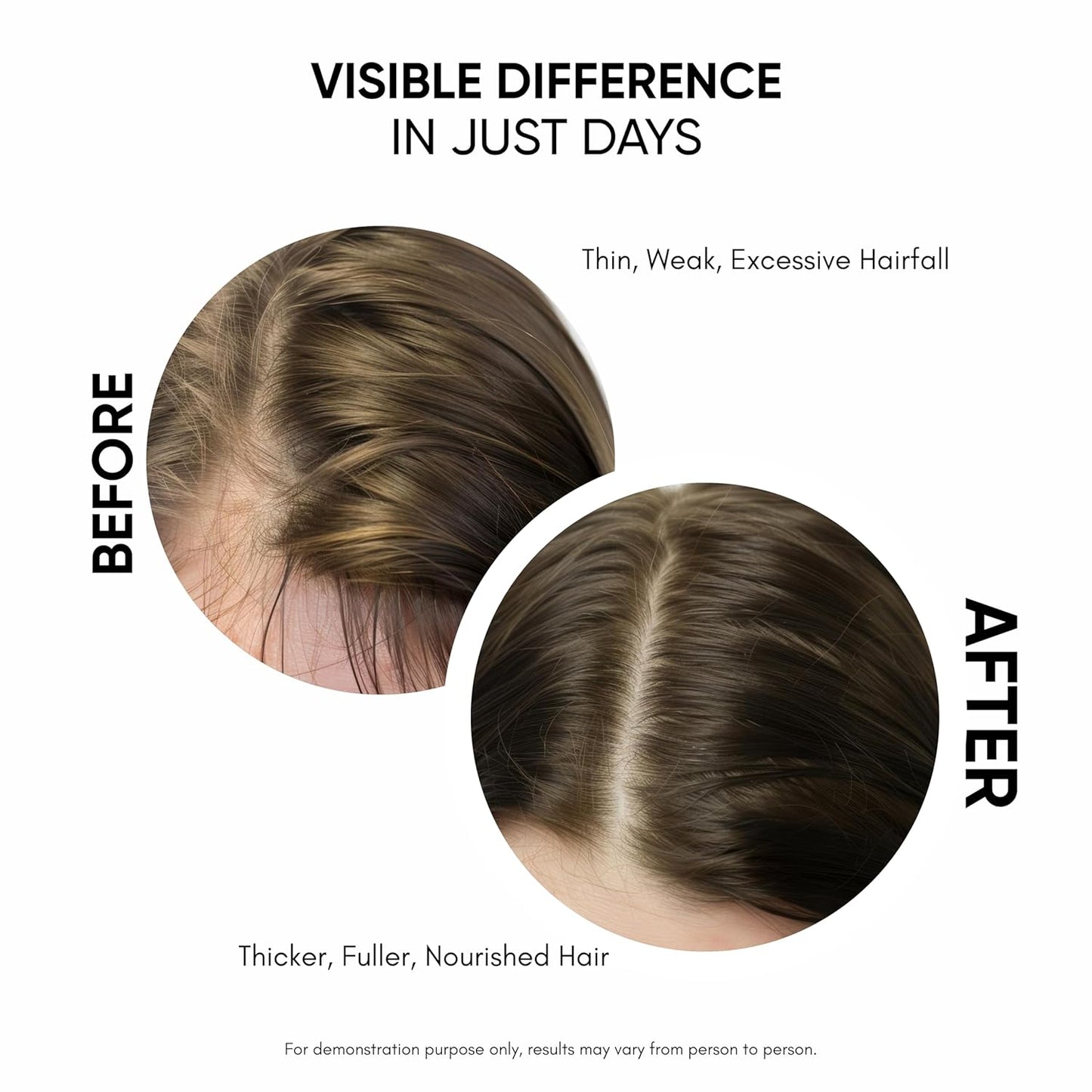 Hair Growth Serum - Density & Hair Fall Control with 3% Redensyl, Rosemary & Biotin | 1.01 fl. oz. (30ML)
