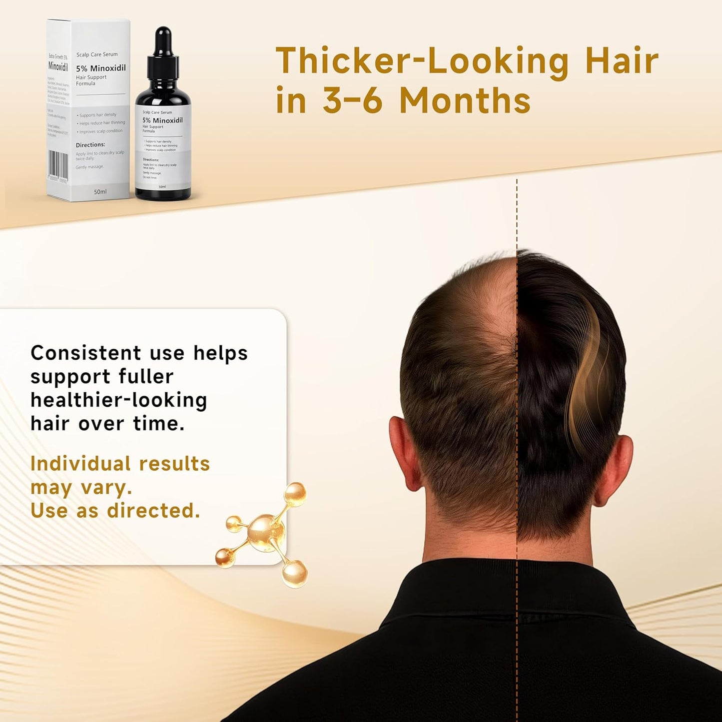 Minoxidil Growth Serum for Hair Loss - Supports Regrowth & Beard Growth | Lightweight Scalp Serum with Rosemary Extract, 1.7 fl oz - White