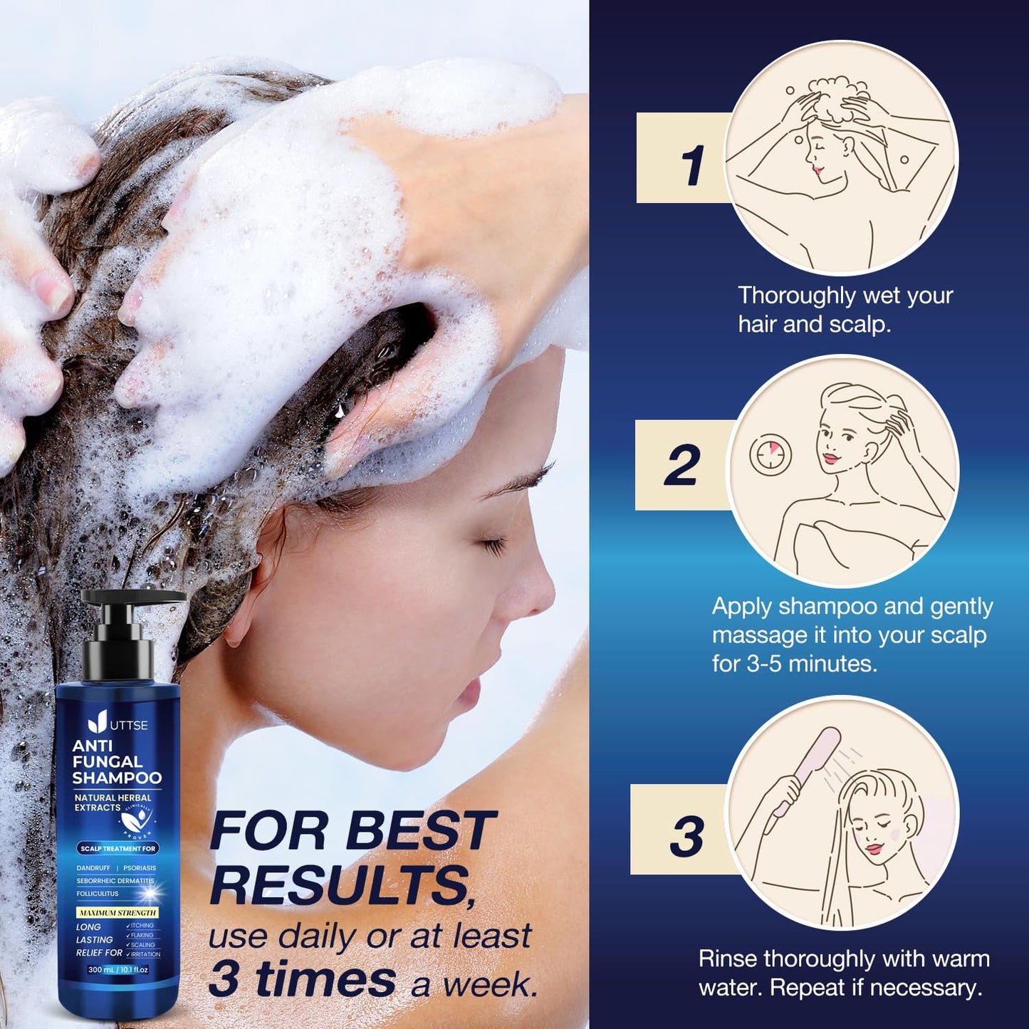 Anti-Fungal Shampoo for Scalp Psoriasis | Dandruff Relief for Folliculitis & Seborrheic Dermatitis - 300 mL / 10.1 fl. oz