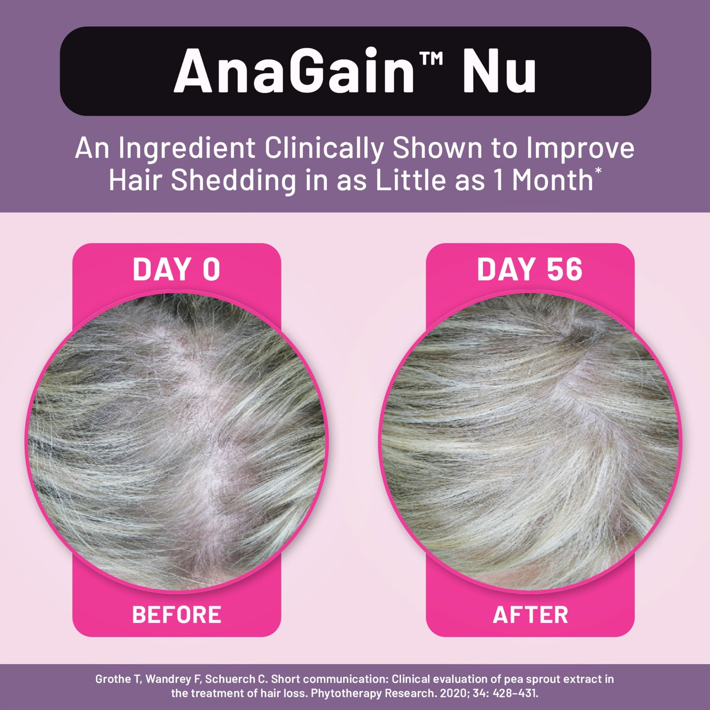 NatureWise Hair Growth Plus - Hair Growth Supplements Women & Men - With Clinically Tested AnaGain Nu + No Biotin - Sugar Free & Vegan - Pistachio Caramel Flavor - 15 Fl Oz [30 Day Supply]
