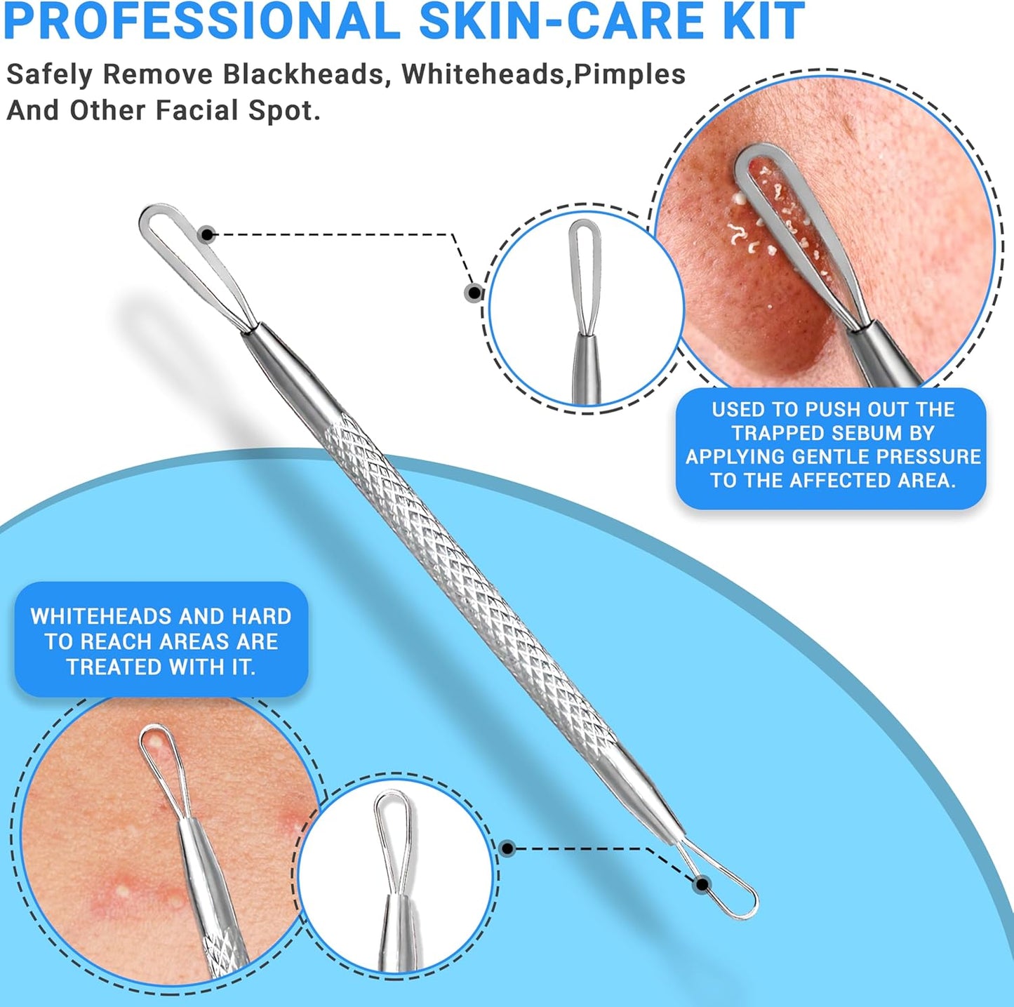 Stainless Steel Pimple Extractor Tool Set - Surgical Acne Treatment | Easy to Clean, 2 Pcs (Silver)