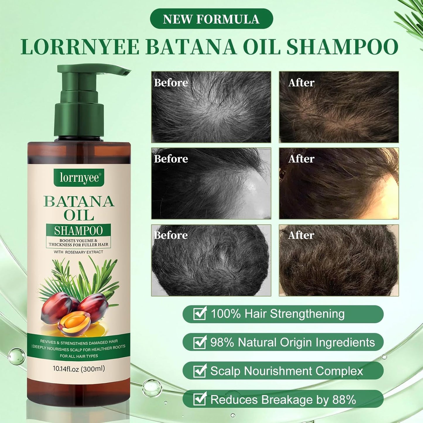 Batana Oil Shampoo for Hair Growth | Organic Rosemary & Biotin Formula - Thicken Thinning Hair for Men & Women | 10.1oz