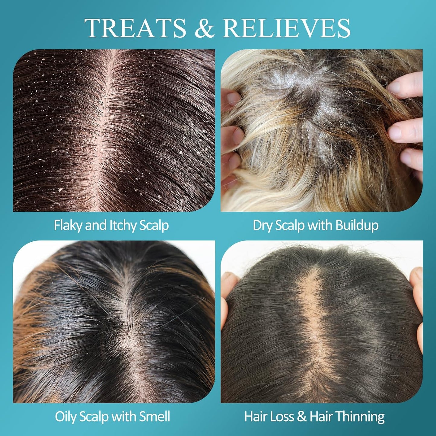 Biotin Scalp Scrub - 2-in-1 Exfoliator & Detox Shampoo with 3% Salicylic Acid | Tea Tree Oil for Dandruff & Itchy Scalp