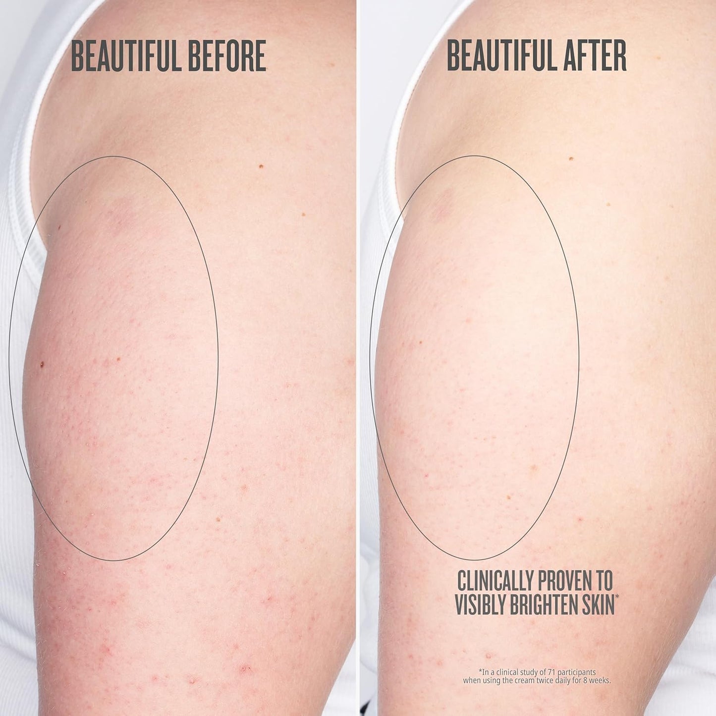 Visibly Brightening AHA Body Cream - Smooth Skin Hydration | 8.1 oz