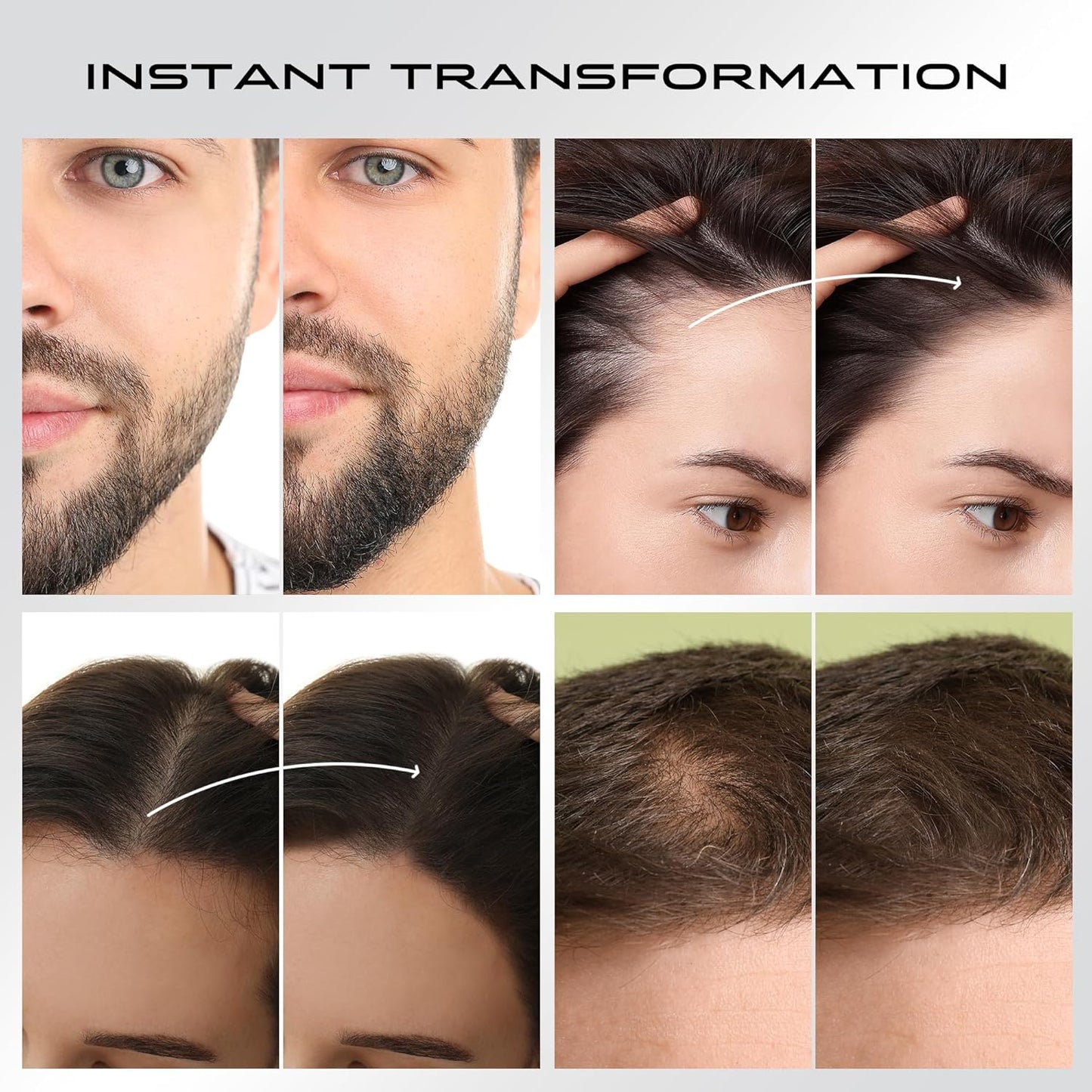 Hair Thickening Fibers - Waterproof Color Powder for Thinning Hair | 28g Black Fill-In for Men & Women