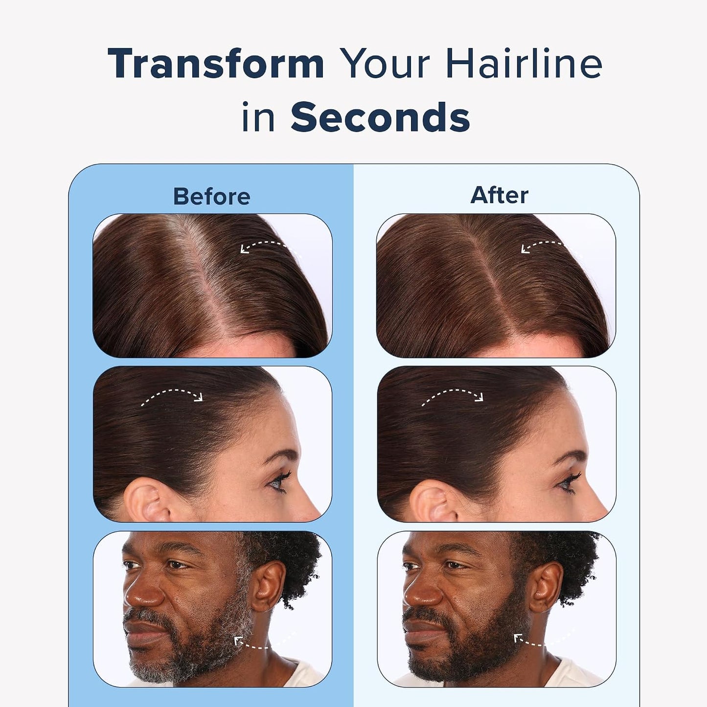 TRUHAIR Color & Conceal Waterproof Root Touch Up - Gray Coverage & Hairline Filling | Auburn Shade