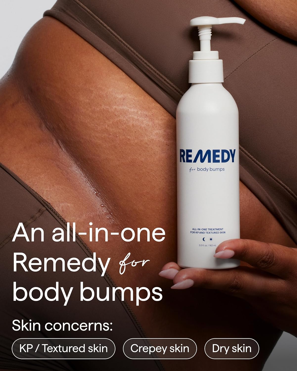 KP Exfoliating Body Moisturizer - Keratosis Pilaris Treatment with Urea & Lactic Acid | Smoothing Lotion for Textured Skin