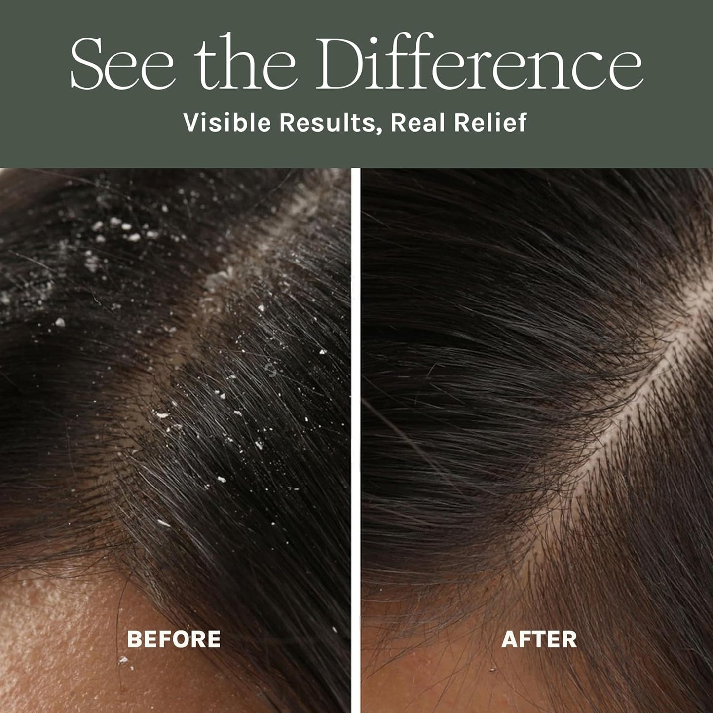 Purist Scalp Mask - Natural Hair Growth Booster | Detoxifying Treatment with Aloe, Neem & Rosemary - Sulfate & Paraben Free
