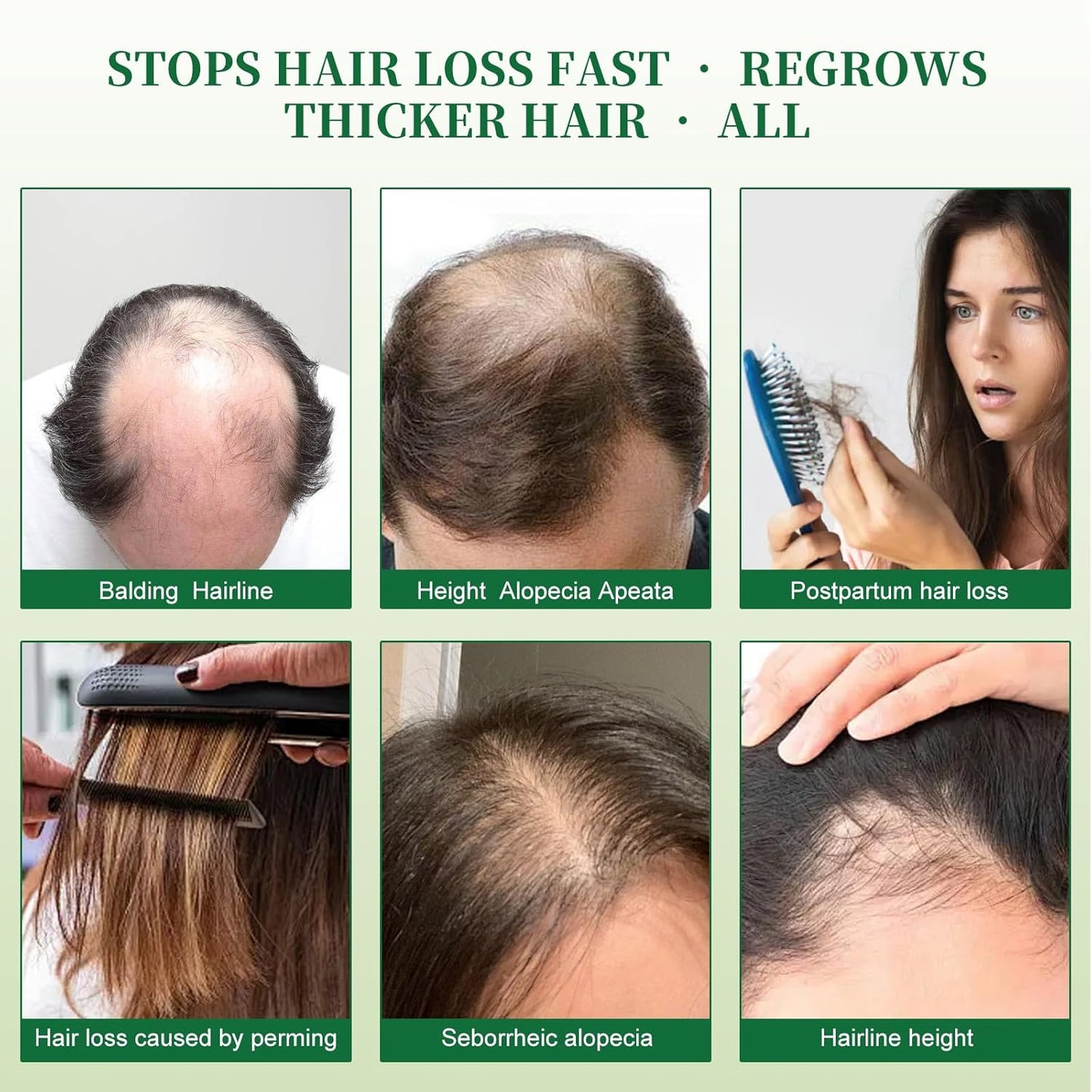Batana Oil Shampoo for Hair Growth | Organic Rosemary & Biotin Formula - Thicken Thinning Hair for Men & Women | 10.1oz