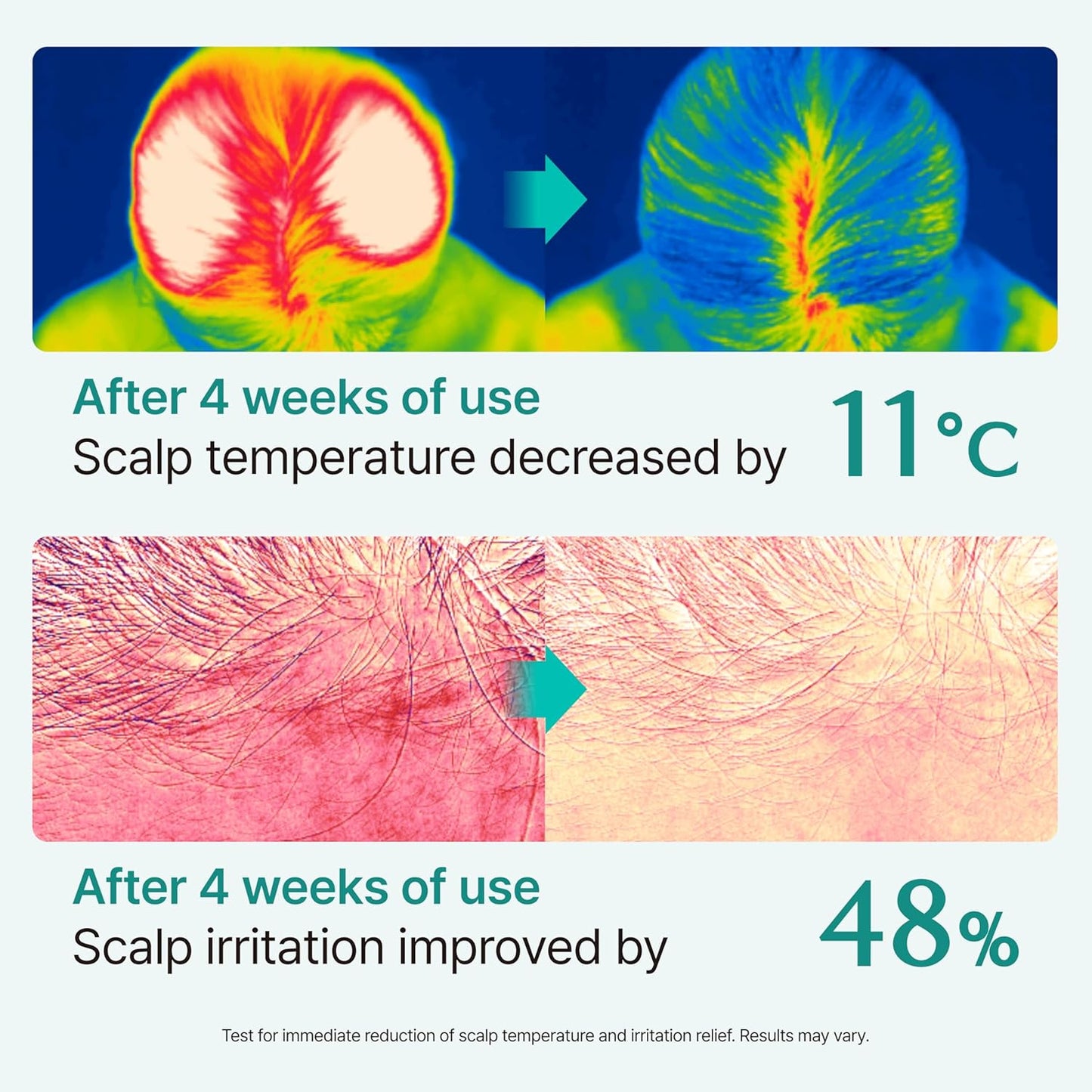 Lilyeve Scalp Serum - Cica PDRN Treatment for Itchy Scalp Relief & Hydration | 1.01 fl. oz.