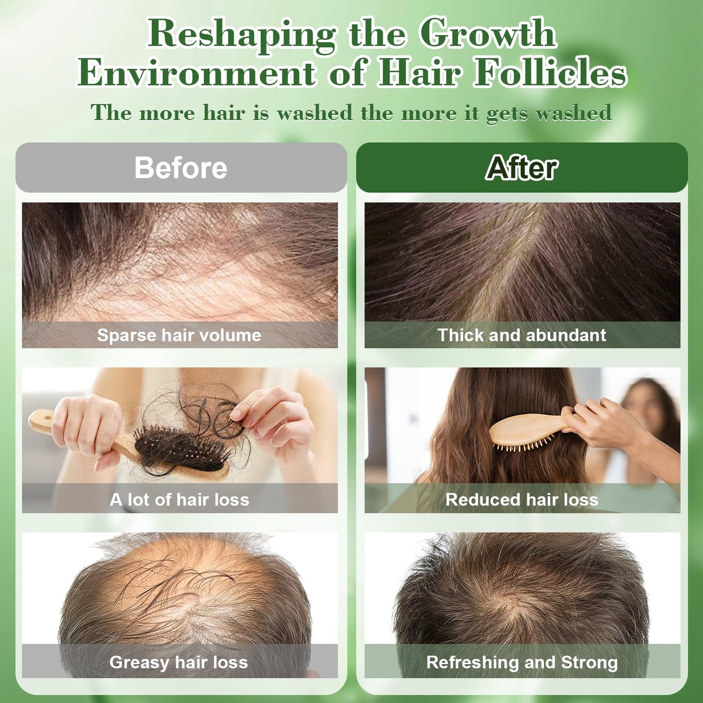 Rosemary Shampoo for Hair Growth - Nourishes Scalp, Reduces Breakage & Adds Shine | 10.1 fl oz