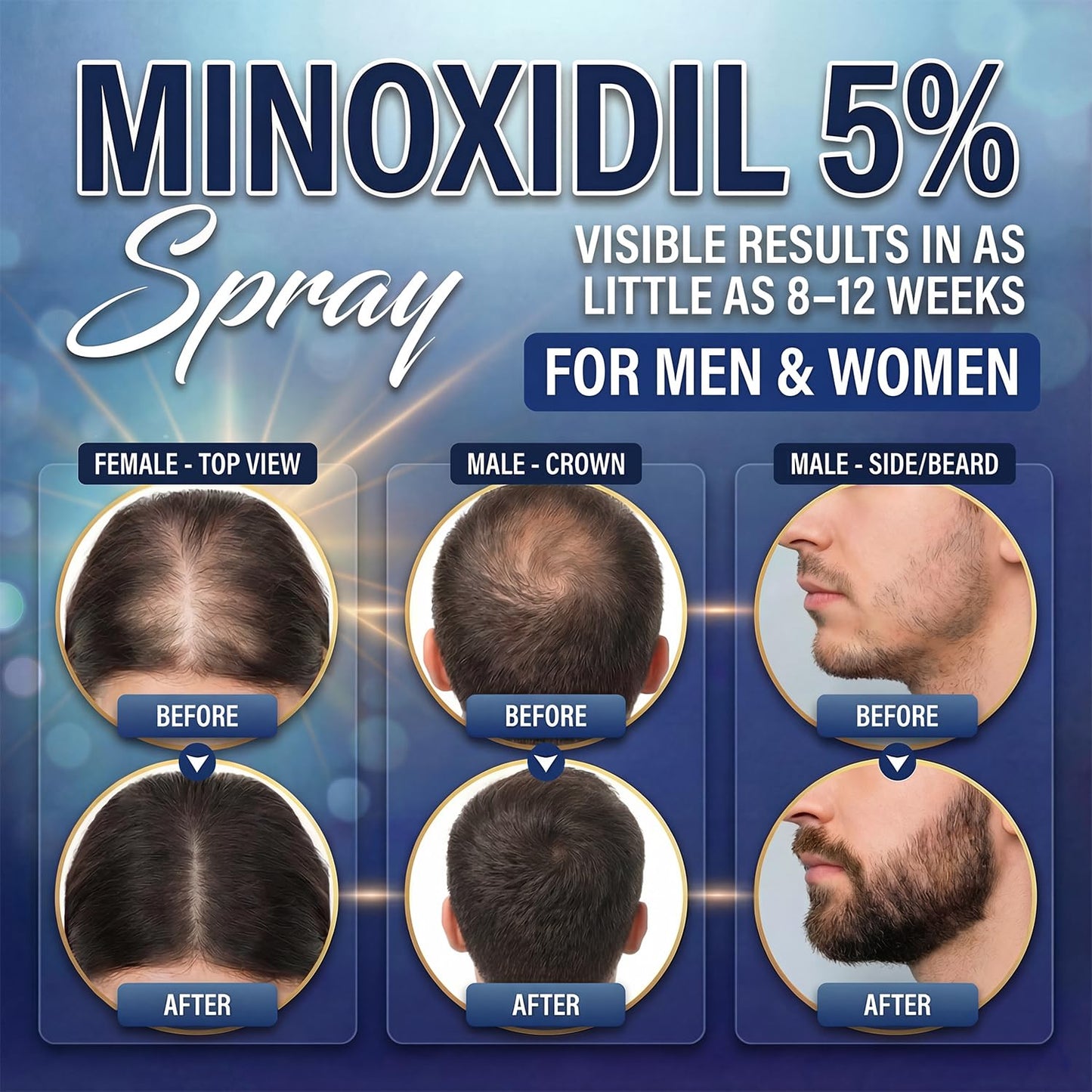 Nigwedete Minoxidil 5% for Men (120 ML), Advanced Minoxidil Spray with Provitamin B5 and Castor Seed Extract, Minoxidil Extract Serum for Hair Loss, Beard Restoration