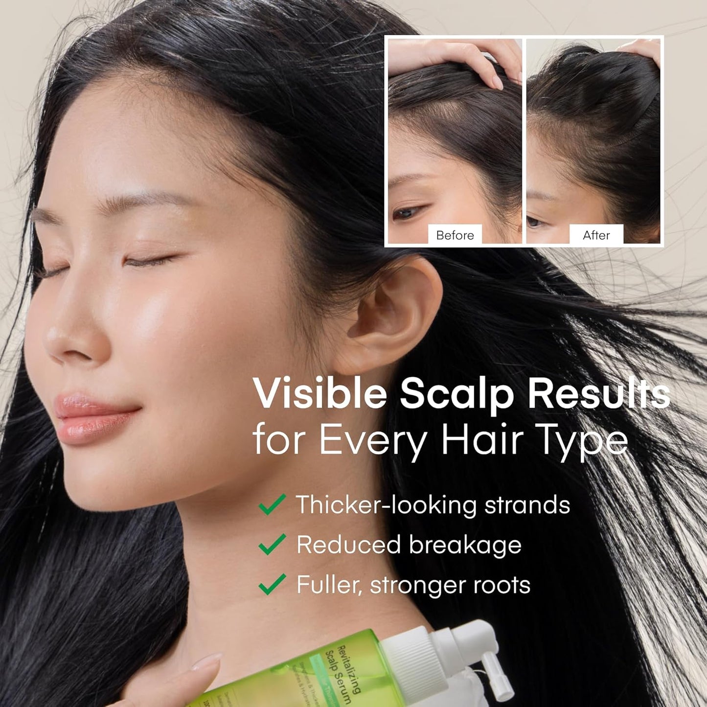 Scalp Serum for Hair Growth - Korean Vegan Treatment for Thinning Hair & Itchy Scalp | Non-Greasy, Lightweight Formula (100 mL)