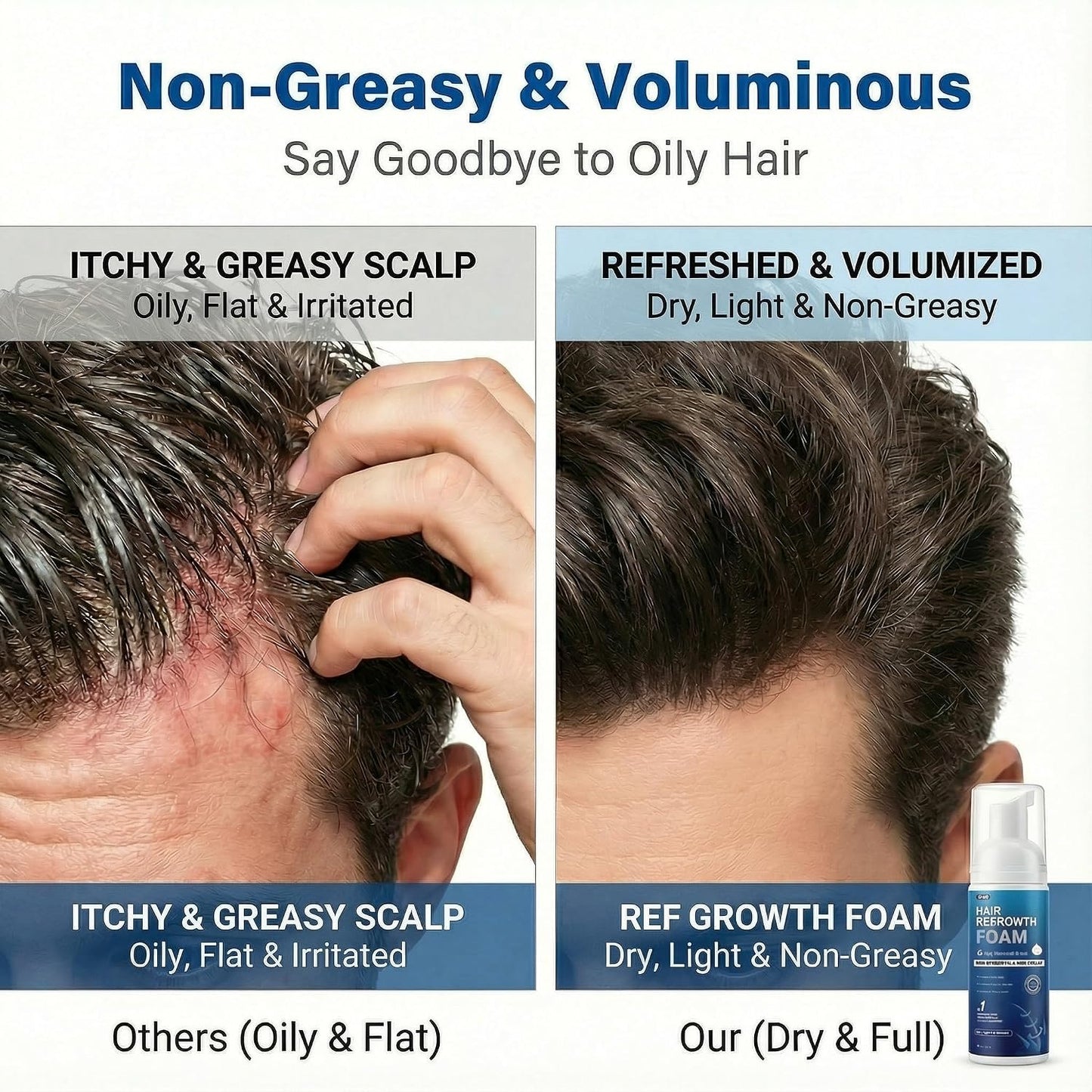 Minoxidil Foam for Men - Fast-Absorbing Hair Regrowth Treatment for Thinning Hair & Beard | 2 x 2.11 Oz (2 Month Supply)