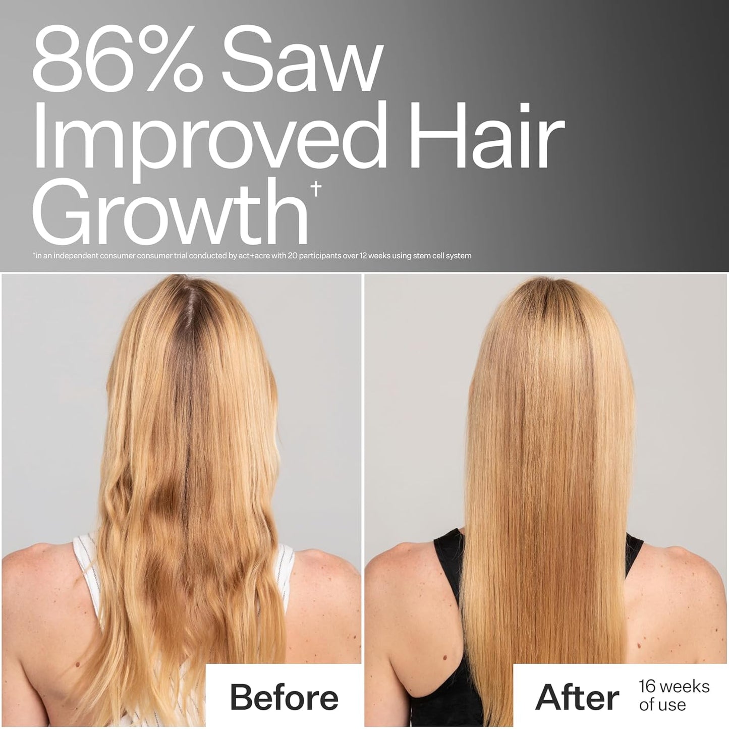 Act+Acre Stem Cell Conditioner - Strengthens & Hydrates Fine Hair | Lightweight, Vegan, Color Safe | 10 Fl Oz