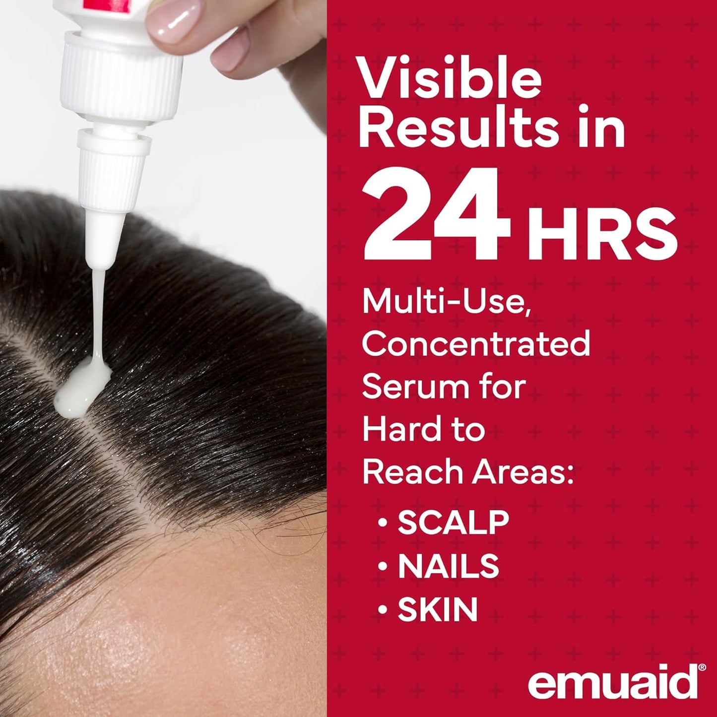 EMUAIDMAX Psoriasis Scalp Treatment Serum - Natural Relief for Dry, Itchy Scalp | 1oz