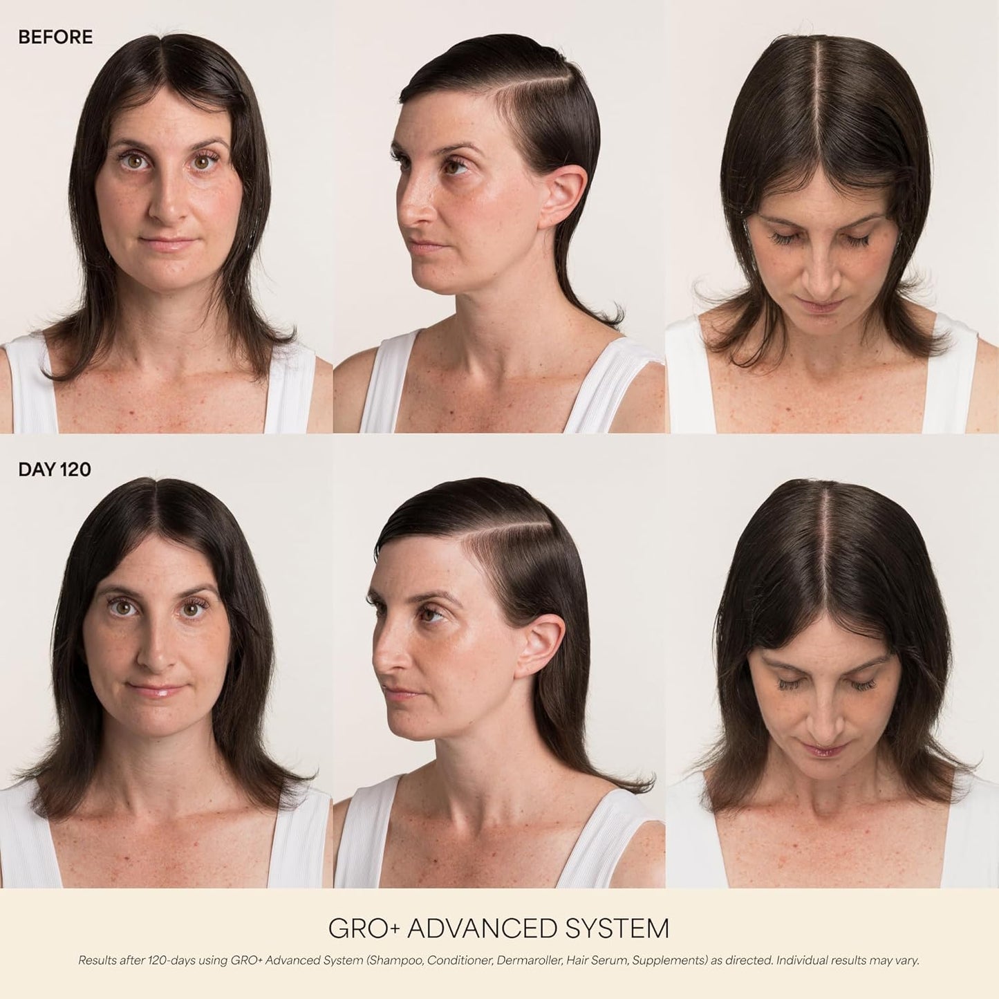 VEGAMOUR GRO+ Advanced Hair Density Gel-Serum | Cooling Massage Pen for Thinning Hair, Vegan & Cruelty-Free