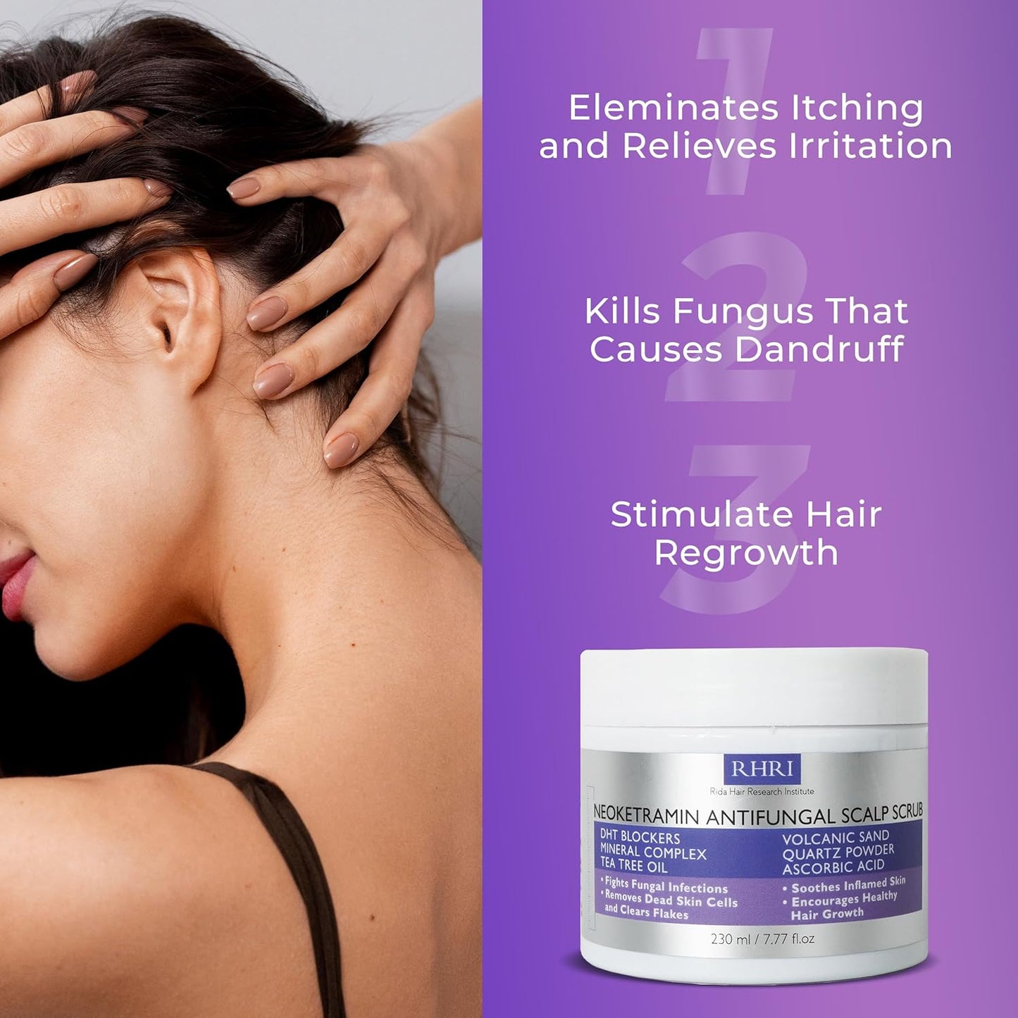 Anti-Fungal Scalp Scrub for Men & Women - Medicated Dandruff Relief for Dry Scalp | Treat Folliculitis, Psoriasis, Ringworm